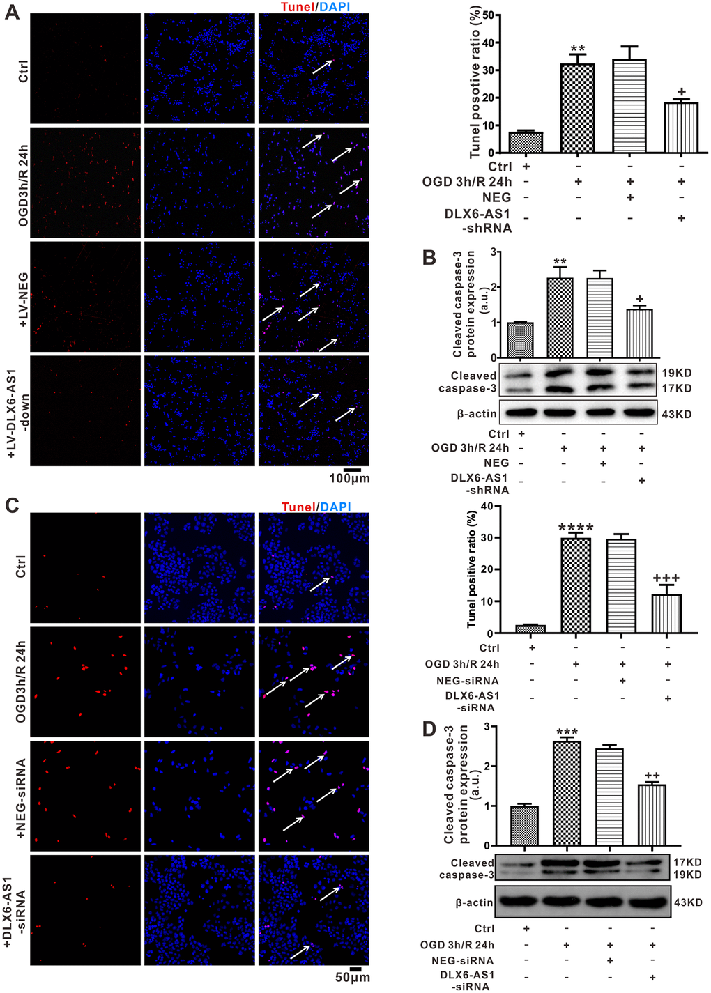 DLX6-AS1 was upregulated in an OGD/R model and DLX6-AS1 silencing reduced apoptosis of N2a and SH-SY5Y cells induced by OGD/R. (A) Representative images and statistics of TUNEL staining of N2a cells used to confirm apoptotic changes (100X). (B) Cleaved caspase-3 protein levels measured by western blotting. (C) Representative images and statistics of TUNEL staining of SH-SY5Y cells used to confirm apoptotic changes (100X). (D) Cleaved caspase-3 protein levels of SH-SY5Y measured by western blotting. Values represent mean ± SEM (n = 3 in each group). **P ++P +++P 