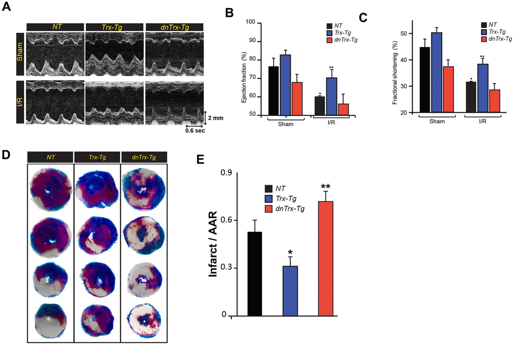 High level of Trx protects against I/R mediated LV dysfunction and infarction of aged myocardium. (A). Representative M-mode images taken from NT, Trx-Tg and dnTrx-Tg hearts of sham (top) and I/R (bottom). Ejection fraction; EF (B) and fractional shortening; FS (C), an index of cardiac contractile function, was determined by echocardiographic analysis. *p NT sham; **p NT or dnTrx-Tg I/R hearts, n=3-5. (D) NT, Trx-Tg and dnTrx-Tg mice were subjected to 60 min ischemia and 30 min reperfusion and then TTC staining was performed as described in the methods section. TTC stains viable tissue brick red and necrotic tissue as white. (E) Infarct area in relation to area-at-risk (AAR). *p NT or dnTrx-Tg I/R; **p NT or Trx-Tg I/R, n=4. Statistical significance was determined with the Student’s t-test.