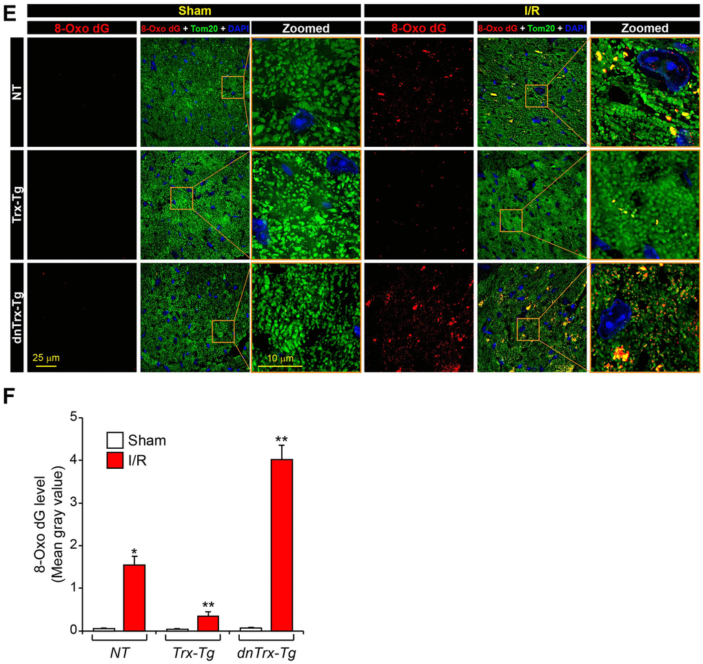 High level of Trx prevents I/R-induced mitochondrial cristae and DNA damage. (E) Immunofluorescence microscopic image shows accumulation of 8-oxo-dG in mitochondria of sham or I/R myocardium sections. (F) The levels of 8-oxo-dG was quantified and expressed as mean gray value. *p NT or dnTrx-Tg I/R; † p NT or Trx-Tg I/R. Statistical significance was determined with one-way ANOVA followed by Tukey’s post-hoc multiple comparisons test.