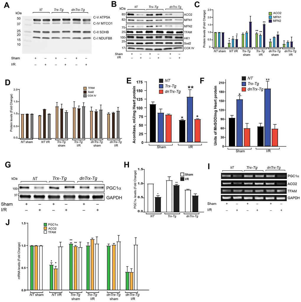 Trx prevents I/R-induced loss of mitochondrial proteins, by upregulating transcription of PGC1α. (A). Mitochondria was isolated from sham or I/R subjected NT, Trx-Tg and dnTrx-Tg mice. The mitochondrial extracts were analyzed for oxidative phosphorylation complex subunits by western blot using Abcam OXPHOS cocktail antibody. (B) Western blot analysis of ACO2, MFN1, MFN2, TFAM, Hexokinase 1 (HK-1), Sod2 and COX IV in sham or I/R mitochondrial extracts from NT, Trx-Tg and dnTrx-Tg mice. (C, D). Protein levels were quantified and expressed as fold change. *p NT sham; **p NT or dnTrx-Tg I/R. (E) Aconitase 2 activity and (F). MnSOD activity was determined in sham and I/R myocardium obtained from NT, Trx-Tg, or dnTrx-Tg mice as described in materials and methods. *p NT or dnTrx-Tg I/R. n=3. (G) AAR region of sham or I/R myocardium from NT, Trx-Tg and dnTrx-Tg were lysed using M-PER lysis buffer and analyzed for PGC1α and GAPDH by western blotting. (H). Level of PGC1α was quantified and expressed as fold change. *p NT sham; **p NT or dnTrx-Tg I/R. (I). RT-PCR analysis of PGC1α, ACO2 and TFAM in sham and I/R myocardium (J). mRNA levels of PGC1a, ACO2 and TFAM were quantified and expressed as fold change. *p NT sham; **p NT or dnTrx-Tg I/R. Statistical significance was determined with the Student’s t test (C, D, H, and J) and one-way ANOVA followed by Tukey’s post-hoc multiple comparisons test (E, and F).