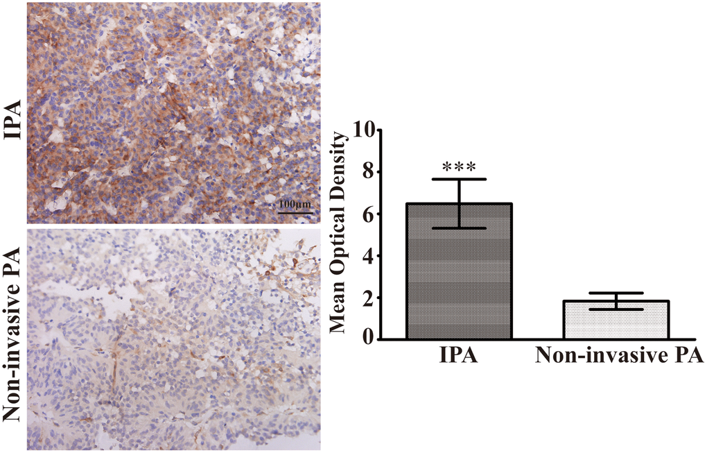 Upregulation of S100A9 in IPA clinical specimens. Immunohistochemical staining(×400) of S100A9 in non-invasive PA and IPA. The mean optical density was used for statistical quantification of S100A9 in non-invasive PA and IPA. (***Pvs. non-invasive PA).