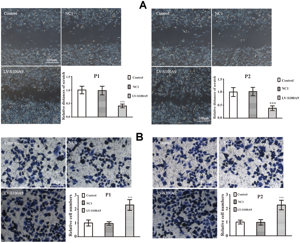 The effects of S100A9 in primary PA. (A, B) Wound-healing assay and transwell system were used to measure the migration and invasion of P1 and P2 cells in control, NC1 and LV-S100A9 groups (n=5. ***P