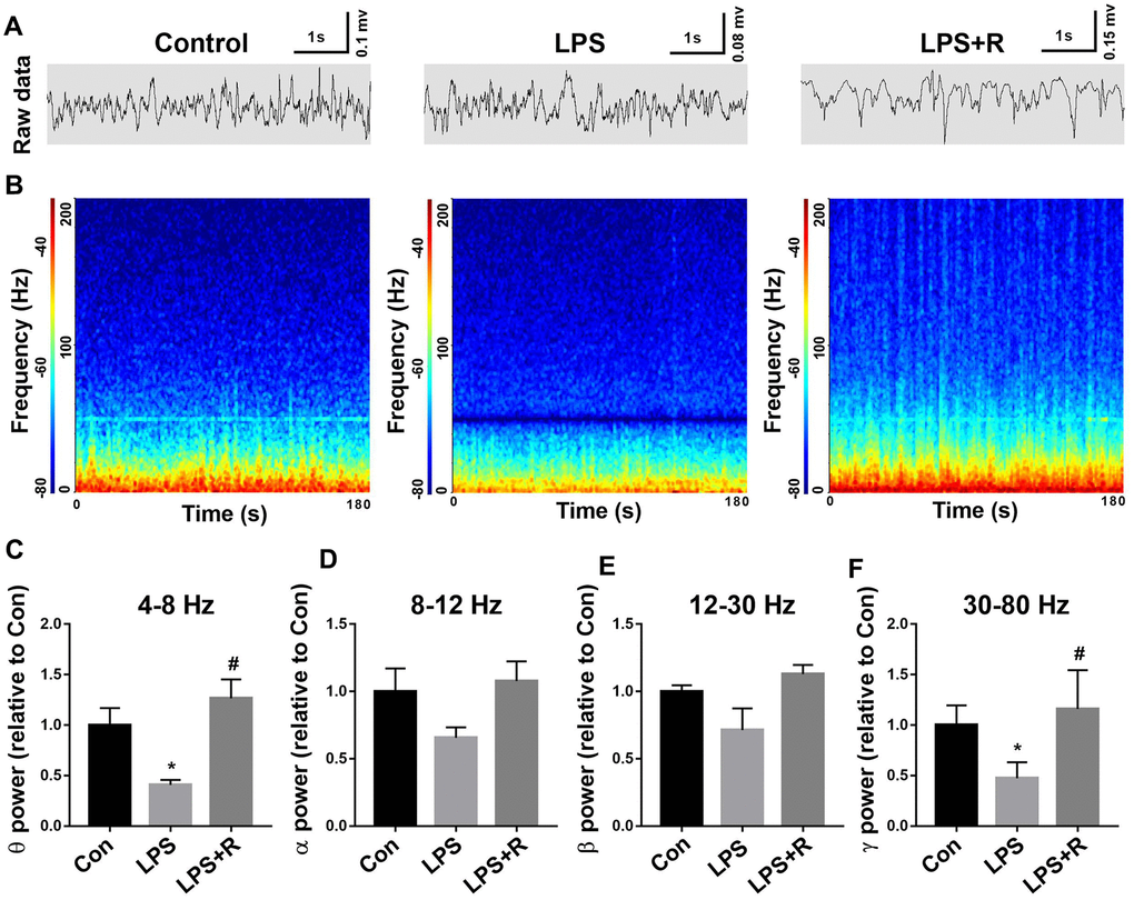 Decreased gamma oscillation in the CA1 of the hippocampus following LPS challenge was prevented by roscovitine. (A, B) Example recordings and example power spectra in the hippocampal. (C–F) Summary of LFP power, including θ, α, β, and γ oscillation. The theta and gamma oscillation powers were significantly lower in LPS group when compared with control group, which were prevented by roscovitine. Data are shown as mean ± SEM, n = 4, *P P 