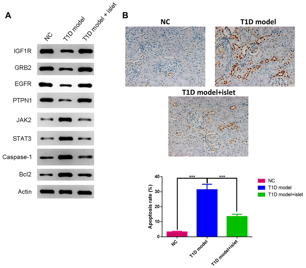 The expressions of IGF1R, GRB2, EGFR, PTPN1, JAK2, STAT3, Caspase-1 and Bcl2 in islet grafts was analyzed by WB and cell apoptosis by TUNEL. (A) The protein expression of IGF1R, GRB2, EGFR, PTPN1, JAK2, STAT3, Caspase-1 and Bcl2 in islet grafts was detected by WB. (B) TUNEL staining for different groups.