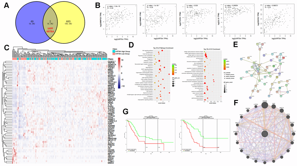 KRT6A may participate in regulating TAMs in PDAC. (A) Venn diagram of common DEGs between PDAC and ANT and between the M0-high group and the M0-low group. (B) Correlation of gene expression between KRT6A and various TAM-related genes in PDAC. (C) Heatmap of TAM-related gene expression patterns of the KRT6A-high group and KRT6A-low group in PDAC. (D) KEGG (left) and GO (right) pathway enrichment analyses of DEGs between the KRT6A-high group and the KRT6A-low group. (E, F) Protein-protein interaction network related to KRT6A using STRING (E) and GeneMANIA (F). (G) Survival analysis of the KRT6A-high group and the KRT6A-low group in TCGA PAAD data (left) and GSE57495 (right).