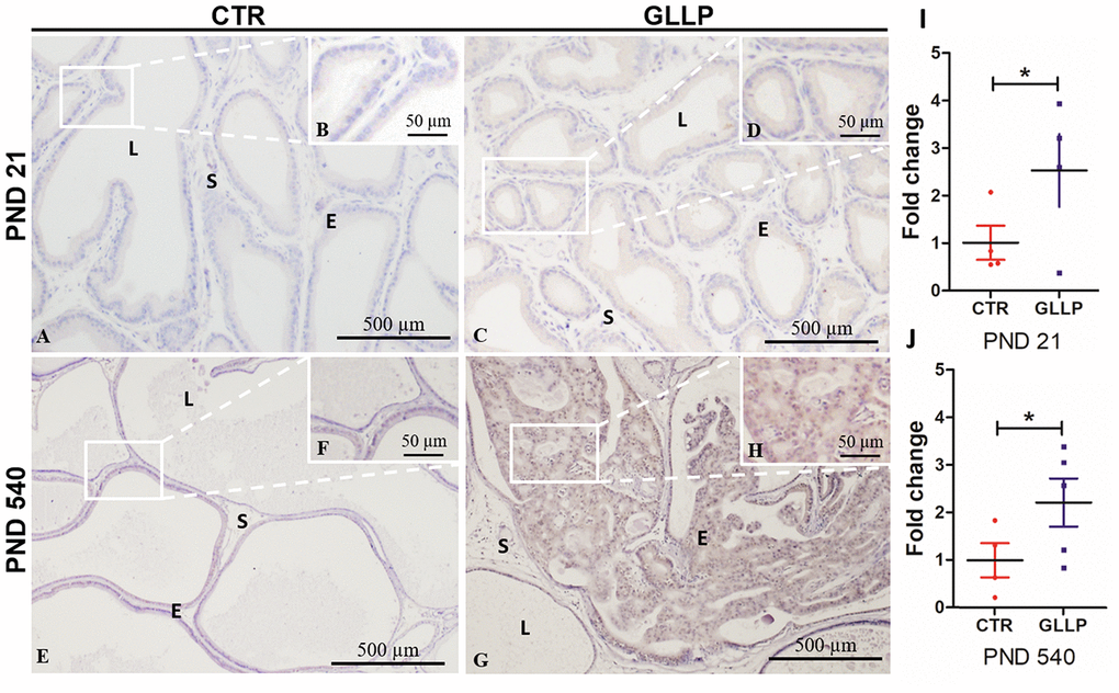 Representative immunohistochemistry reaction for Calreticulin (CALR) in the VP lobes from the CTR and GLLP groups on PND 21 (A–D) and 540 (E–H). RT-qPCR reaction for CALR in the VP lobes from CTR and GLLP groups on PND 21 (I) and 540 (J). CTR = control; GLLP = gestational and lactational low protein; PND = postnatal day. Data are expressed as fold change {plus minus} SD. Asterisks (*) means the statistical difference between experimental groups with p 