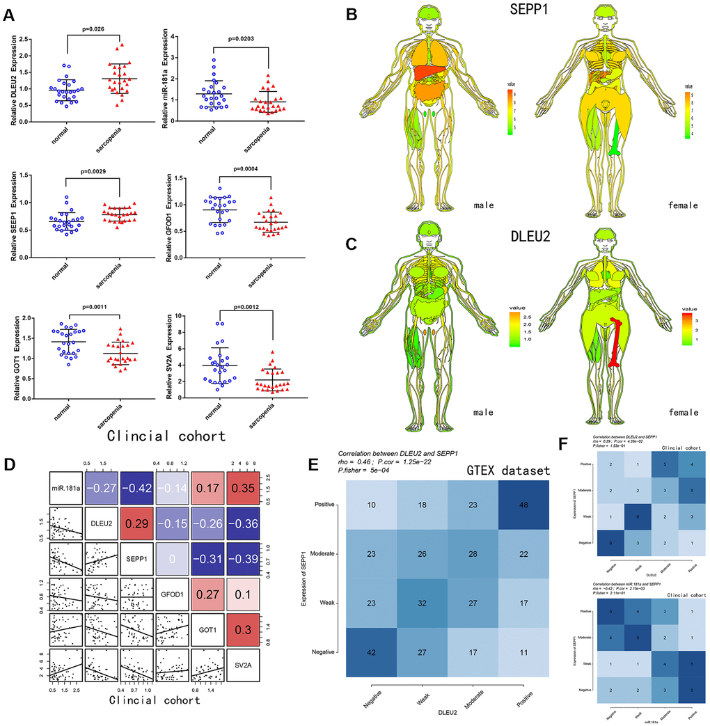 (A) Relative expression of DLEU2, miR-181a, SEPP1, SV2A, GOT1 and GFOD1 as detected by qPCR in samples from clinical cohorts. (B) SEPP1 is downregulated in muscle tissues (GTEX cohort; n =7858). An expression map showing SEPP1 protein expression in human tissues. (C) DLEU2 is downregulated in muscle tissues (GTEX cohort; n =7858). An expression map showing DLEU2 protein expression in human tissues. (D) Correlations among DLEU2, miR-181a, SEPP1, SV2A, GOT1 and GFOD1 in muscle tissues (clinic cohort; n = 50). (E–F) Comparison of expression scores of DLEU2 with those of SEPP1 or miR-181a in muscle tissues. The correlations shown are for muscle tissues from clinical cohorts (n=50) and normal muscle tissues from GTEX cohorts (n=396).