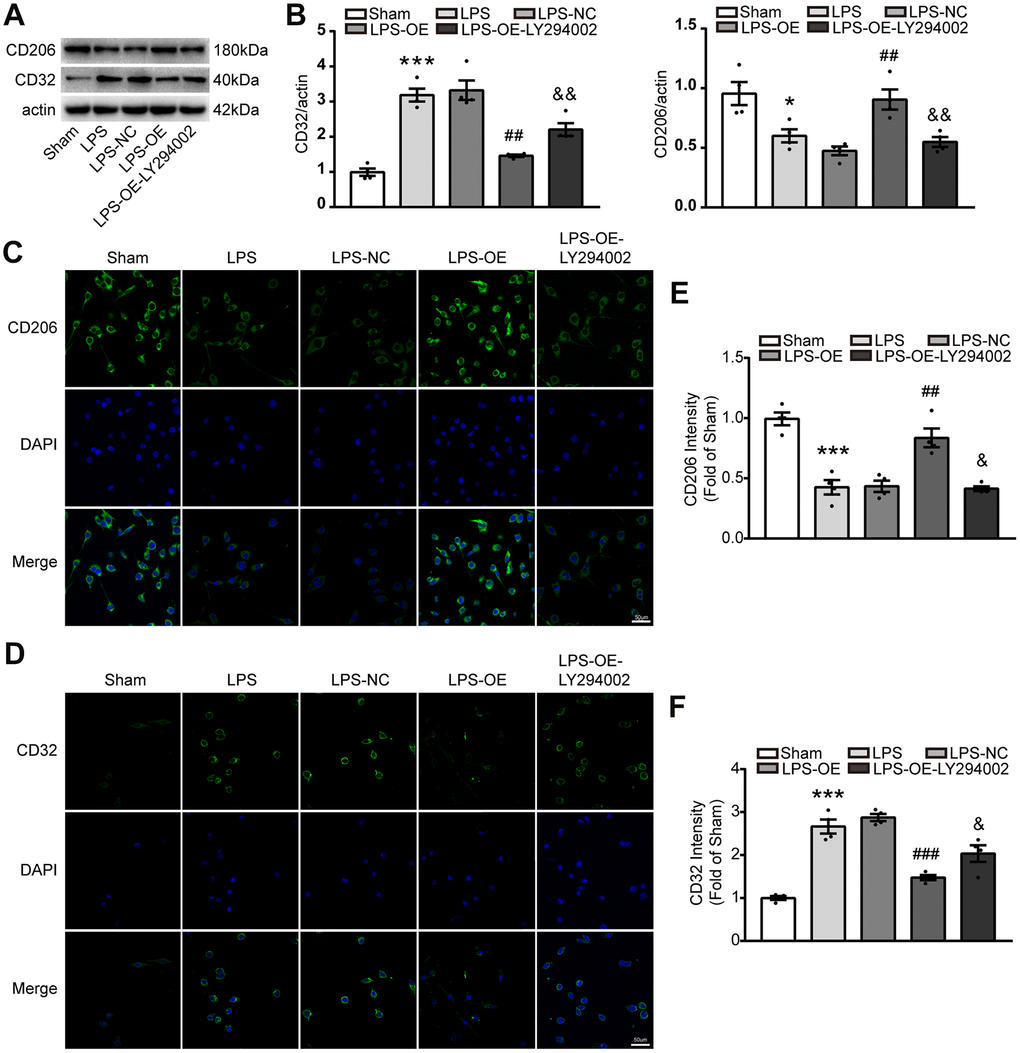 TREM2 overexpression decreases the number of M1 microglia via PI3K-FoxO3a pathway, but increased the number of M2 microglia. (A, B) Meaningful western blot bands (A) and their quantification (B) of CD32 and CD206 (n=4). (C–F) M2 and M1 microglia were evaluated with stained CD206 (C) or CD32 (D), respectively, by confocal microscope and their quantitative analysis of CD 206 (E) and CD32 (F). n=4 per group, 9 fields/sample. Scale bar=50 μm. * P