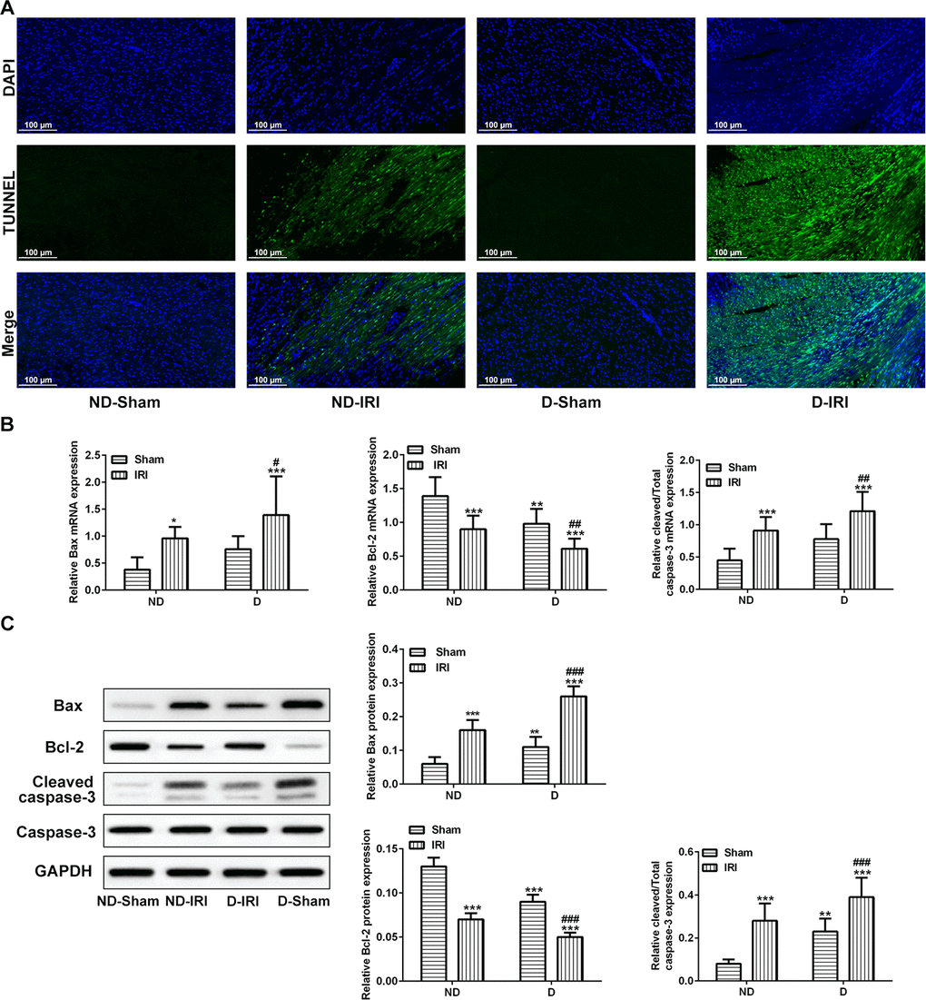 Observation for the apoptosis and associated biomarkers. (A) Apoptosis in myocardium was determined by TUNEL analysis. Scale bar=50 μm. (B) mRNA levels of Bcl-2, Bax, and cleaved caspase-3 detecting by RT-qPCR. *P**P***P#P##PC) Protein levels of Bcl-2, Bax, and cleaved caspase-3 detecting by western blot assay. **P***P###P