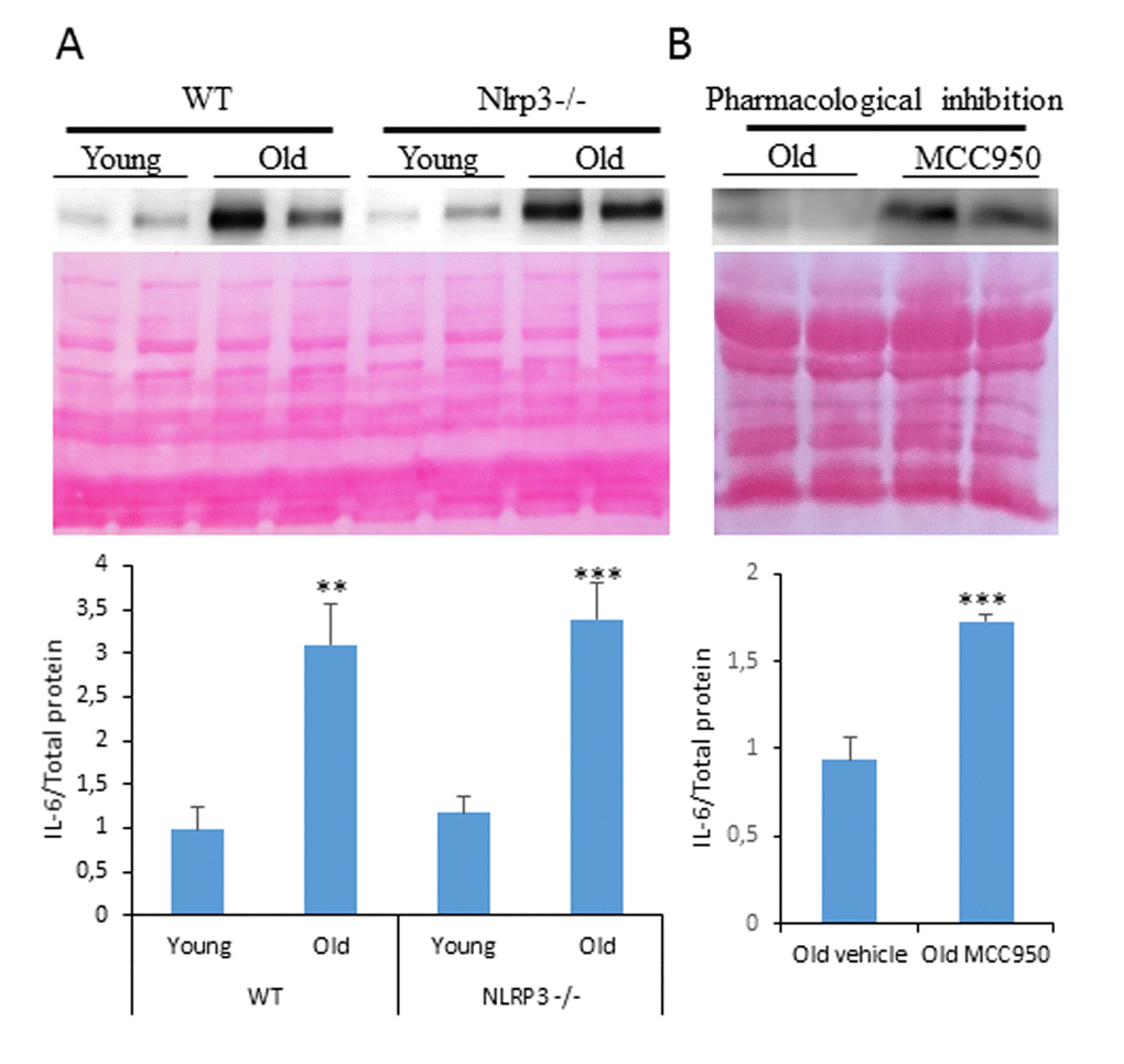 Changes in the autophagy and inflammation observed in ovaries from young and old mice. (A) Western blot analysis with representative blot of IL-6 levels in cardiac tissue of 3 and 20-mo-old WT and Nlrp3 -/-. (B) Western blot analysis showing the protein expression of inflammatory markers IL-6 in cardiac tissues of old mice after MCC950 treatment. n= 4 mice per group and age. Densitometric analysis is shown as means ± SD. ***P vs old mice.