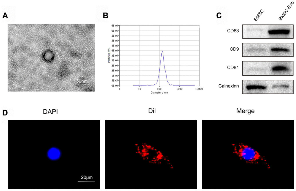 Characterization and uptake of BMSC exosomes. (A) Transmission electron microscopy (TEM) showed that BMSC-derived exosomes had a typical cup-like morphology. Scale bar: 50 nm. (B) Nanosight Tracking Analysis (NTA) detection revealed that the average vesicle diameter was about 140 nm. (C) Western blot analysis of exosome lysates revealed positive expression of the exosome surface markers, CD63, CD81 and CD9. No cerulein was detected in BMSC-derived exosomes. (D) Detection of exosome uptake by BMSCs. Dil : red, DAPI: blue. Scale bar: 20 μm.