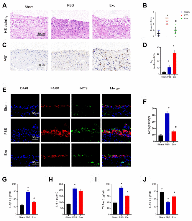 BMSC exosomes reduced synovial macrophage infiltration, induced changes in M1/M2 subsets, and reduced inflammation in the rat model. (A) Representative images of HE staining in synovial tissue. Scale bar: 50 μm. (B) Quantification of synovitis scores in synovial tissue. (C) and (D) Immunohistochemistry and analysis of Arg1 in synovial tissue, respectively. Scale bar: 50 μm. (E) and (F) Immunofluorescence and analysis of F4/80 and iNOS, respectively, in synovial tissue. Scale bar: 50 μm. (G–J) Determination of the cytokines, IL-1β, IL-6, TNF-α, and IL-10 in synovial fluid from each test group. * p 