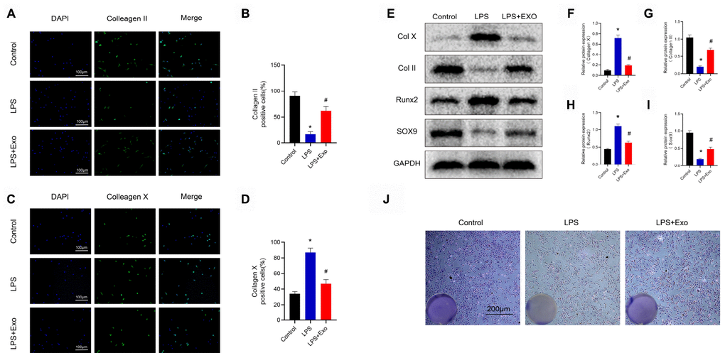 Macrophages treated with BMSC exosomes maintain chondrogenic characteristics and inhibit hypertrophy of chondrocytes. (A) and (B) Detection of the expression of collagen II by immunofluorescence in chondrocytes and statistical results. Scale bar: 100 μm. (C) and (D) Detection of the expression of collagen X by immunofluorescence in chondrocytes and statistical results. Scale bar: 100 μm. (E–I) Detection of the expression of collagen II, collagen X, SOX9 and Runx2 in chondrocytes by western blotting and statistical results. (J) Image of toluidine blue staining of chondrocytes. Scale bar: 200 μm. *p 