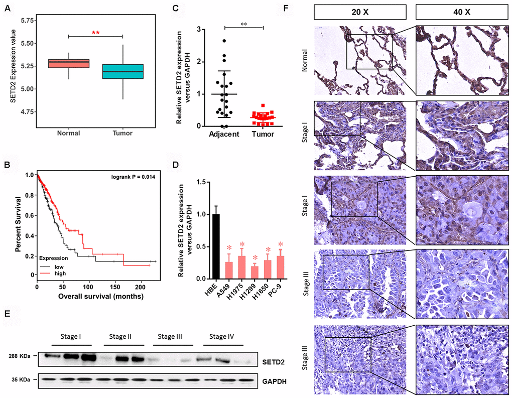 SETD2 is clinically relevant in human LUAD. (A) Box plot of SETD2 expression levels in patients with lung cancer from TCGA. (B) The association of SETD2 expression at the mRNA level and overall survival using TCGA data (P values by log-rank test). (C) Scatter plot of SETD2 expression levels in LUAD tumors and adjacent normal epithelial tissues. (D) Real-time qPCR analysis of SETD2 expression in HBE cells and human lung cancer cell lines A549, H1975, H1299, H1650 and PC-9. (E) Western blotting analyses of SETD2 expression at the protein level in four clinical stages of lung cancer progression using human lung tissue specimens. (F) SETD2 staining of human lung cancer tissues with four clinical stages of cancer progression. Scale bars: 50 μm. *PPt test.