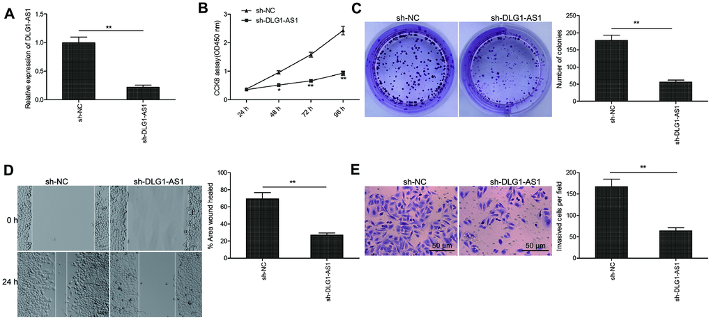 Knockdown of DLG1-AS1 inhibited cell viability and invasion of PTC cells. (A) The expression of DLG1-AS1 is downregulated in TPC-1 cells transfected with sh-DLG1-AS1 or sh-NC. (B–E) Knockdown of DLG1-AS1 inhibits proliferation, colony formation, migration, and invasion in TPC-1 cells transfected with sh-DLG1-AS1 or sh-NC. All experiments were performed in triplicate, and data are expressed as mean ± standard deviation (SD) (*P P 