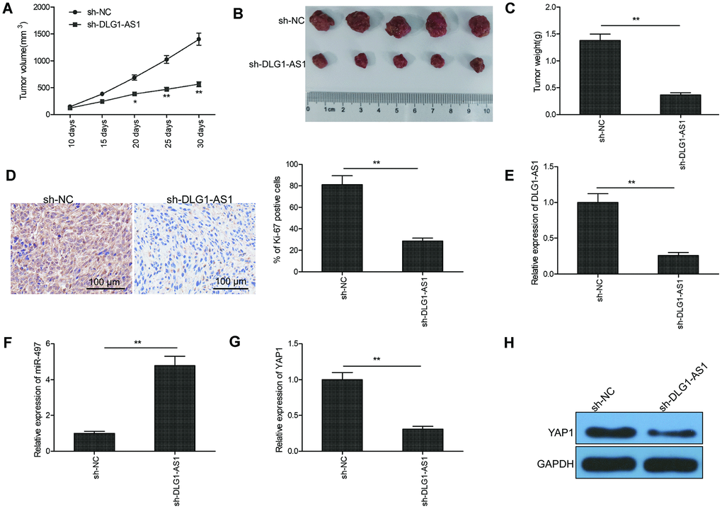 Knockdown of DLG1-AS1 suppressed tumor growth in PTC xenograft model. (A) Tumor volumes were examined every 7 days until the mice were sacrificed. (B) Tumor image was captured at the end of experiments. (C) Tumor weight was measured at the end of experiments. (D) The expression of Ki-67 was determined in xenograft tumor by immunohistochemistry (IHC). (E) The expression of DLG1-AS1 was determined in xenograft tumor by quantitative real-time polymerase chain reaction (qRT-PCR). (F)The expression of miR-497 was examined in xenograft tumor by qRT-PCR. (G, H) The mRNA and protein expression of YAP1 measured in xenograft tumors. All experiments were performed in triplicate and data are expressed as the mean ± standard deviation (SD) (*P P 