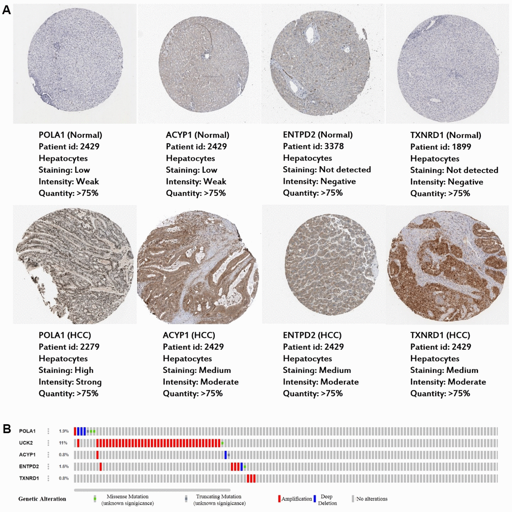 Expression and genetic alterations in the five prognosis-related metabolic genes. (A) The representative protein expression of the four genes in HCC and normal liver tissues. Data are from the Human Protein Atlas (http://www.proteinatlas.org) [51] database. Data for UCK2 were not found in the database. (B) Genetic alterations to the five genes in TCGA-LIHC. Data are from the cBioportal for Cancer Genomics (http://www.cbioportal.org/) [52, 53].