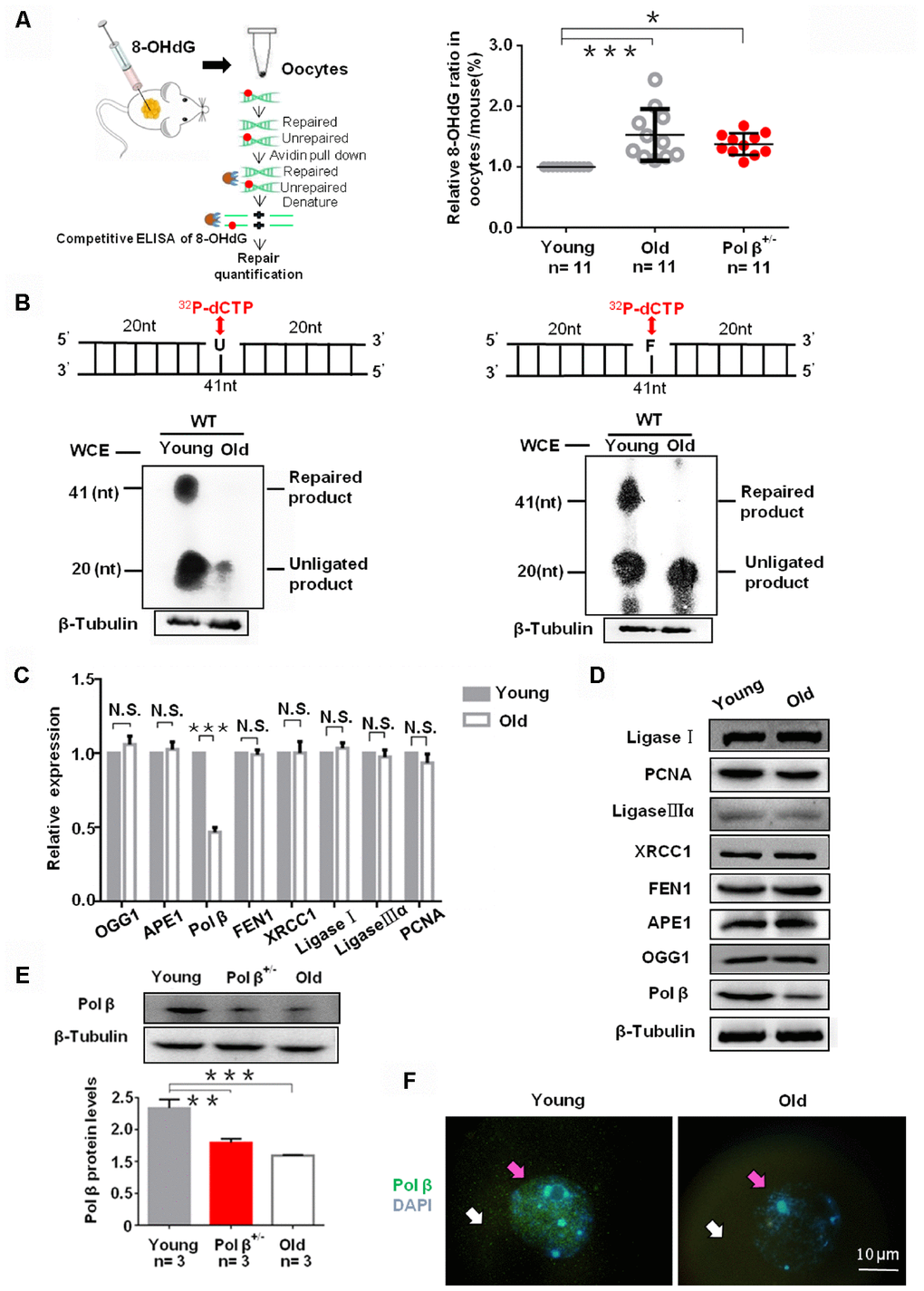 Aging reduce BER efficiency by low expression of Pol β in mouse oocytes. (A) Three equal dose of DNA oligo containing the damaged DNA lesion 8-OHdG was respectively transfected into young/old Pol β+/- mice ovary; 4h later, oocytes were lysed, and released 8-OHdG was determined by ELISA. With increasing age, reduced 8-OHdG repair was detected, indicating that age inhibits endogenous BER. Scatter graphs represent the content of 8-OHdG in oocytes, with a significant increase in the content of 8-OHdG in old (8 months) / Pol β+/- mice (6-8 weeks) compared to that in young mice (6-8 weeks) (n=11 per group; n stands for the number of mice, ***PB) young/old oocytes, which were respectively divided into two parts for western blotting and BER assays, are defective in BER repair efficiency using whole-cell extract. The number of total oocytes in each line of the gel was detected to be approximately 500 and approximately 700, respectively. SP-BER: reconstitution with young and old oocytes. LP-BER: reconstitution with young and old oocytes. In this assay, whole young and old oocyte extracts were prepared to test SP-BER and LP-BER. Uracil or THF lesions were efficiently repaired by young oocytes but not by old oocytes. (C) Significant decrease in the expression of DNA repair genes in old mice (8 months) compared to that in young mice (6 to 8 weeks) shown by qRT-PCR. All results are the mean ± SD (n = 4 per group). Bar graphs represent the gene expression levels. The bar graphs show significantly lower levels of expression for Pol β in old mice than in young mice (***P D) Significant decrease in the expression of Pol β in old mice (8 months) compared to that in young mice (6 to 8 weeks) shown by western blotting, whereas, no significant difference in other genes. (E) Significant decrease in the expression of Pol β in old (8 months) / Pol β+/- mice (6-8 weeks) compared to that in young mice (6 to 8 weeks) shown by western blotting. We also show the quantitation with error bars (n=3 per group; n stands for the number of mice, *** PF) Significant decrease in the expression of Pol β in old mice (8 months) compared to that in young mice (6 to 8 weeks) shown by photomicrographs. Representative photomicrographs show lower amounts of Pol β (green) protein expression in old mice than in young mice. Oocytes were counterstained with DAPI (blue). White arrows point to the cytoplasm and pink arrows to the nucleus. All bargraphs show the means ± SD.