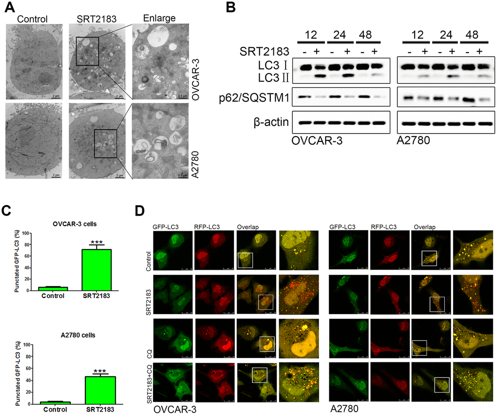 SRT2183 induces autophagy in ovarian cancer cells. (A) OVCAR-3 and A2780 cells were treated with vehicle or 1 μM SRT2183, then observed by transmission electron micrograph (TEM). (B) After incubation with 1 μM SRT2183, the expression of LC3 and p62/ SQSTM1 was detected by western blot. (C) OVCAR-3 and A2780 cells were pre-transfected with GFP-LC3, after 24 h the cells were treated with vehicle or 1 μM SRT2183 for 24 h. The LC3 was observed by confocal microscope. (D) OVCAR-3 and A2780 cells were transfected with GFP- RFP-LC3 for 24 h and pre-treated with chloroquine (CQ) for 6 h, then the cells were treated with vehicle or 1 μM SRT2183 for 24 h. Images were obtained by a confocal microscope. Red dot (GFP−, RFP+): autolysosomes; yellow dot (GFP+, RFP+): autophagosome. N=3 for (A), (B) and (D). N=6 for (C), *** indicates P 