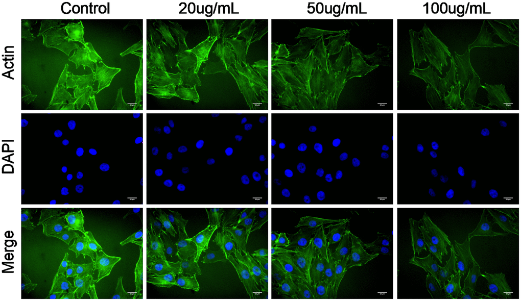 Multiwalled carbon nanotubes (MWCNTs) disrupts actin cytoskeleton of SKOV3 cells. Actin cytoskeleton of SKOV3 cells treated with different doses of MWCNTs under confocal microscopy.