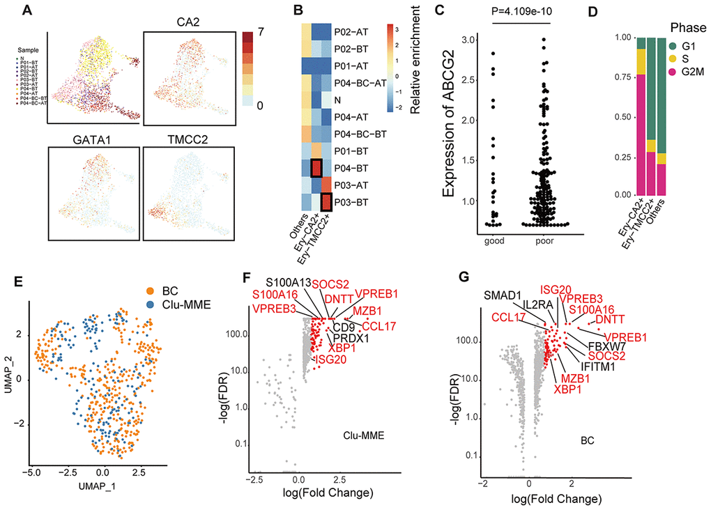 Comparison of erythrocytes and Clu-MME with bone marrow CML datasets. (A) UMAP plot presenting the re-clustering result of erythrocytes. Cells are highlighted with colors indicating sample origin. The expression of GATA1, CA2 and TMCC2 are indicated. The CA2- and TMCC2-expressing erythrocytes are separately enriched in P04-BT and P03-BT. (B) Heatmap showing enrichment of samples in each erythroid cluster. Enrichment score was calculated using the Fisher’s exact test and indicated by log10(Odd Ratio). (C) Beeswarm plots showing the expression of ABCG2 between good responders (P01 and P02) and poor responders (P03 and P04). P= 4.109e-10, unpaired t test. (D) Bar plots showing the fraction of cells from different cell cycle phases across different erythrocyte subtypes. (E) UMAP plot showing the integration result of the BC cluster (from the integrated dataset shown in Fig. 2a) and Clu-MME (the numbers of cells in the BC cluster and Clu-MME are 370 and 183, respectively). (F) Scatter plot showing the highly-expressed marker genes in Clu-MME (left) and the BC cluster (right). Significant markers (FDR 2) are shown as red dots. The name of shared marker genes of these two clusters are indicated in red. (G) Heatmap comparing the expression profiles of CD16+ monocytes across different samples. The selected marker genes are indicated.