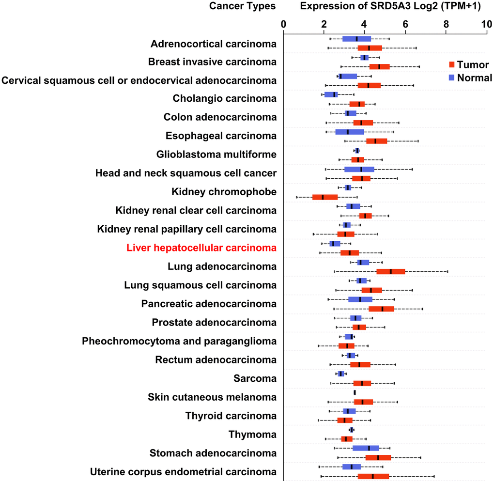 The expression of SRD5A3 in various carcinomas. Transcriptional expression of SRD5A3 in 24 types of cancer (the UALCAN web portal).