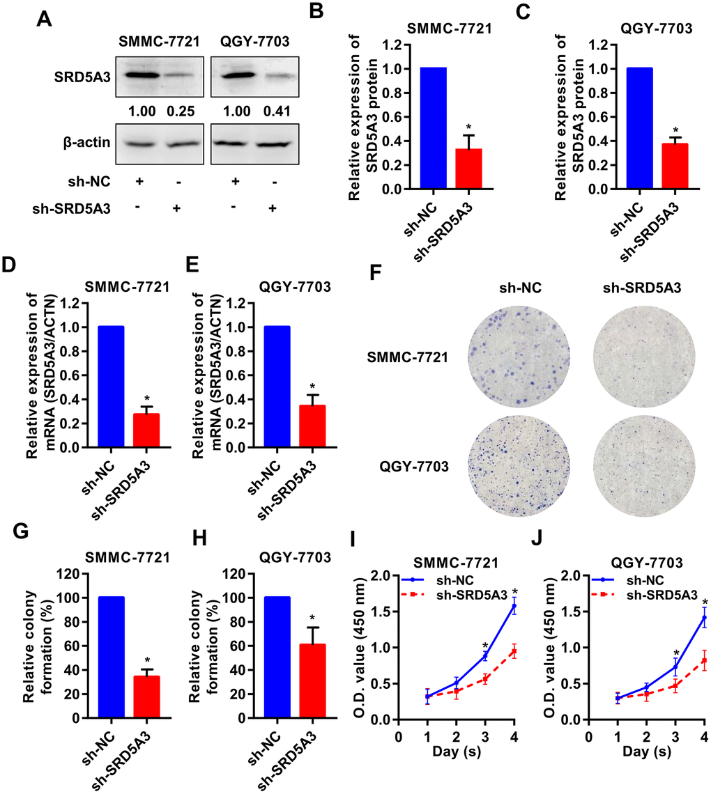 SRD5A3 inhibition suppresses cell proliferation of HCC in vitro. SMMC-7721 and QGY-7703 cell lines were infected with sh-SRD5A3 or sh-NC lentivirus. The knockdown efficiency of SRD5A3 was confirmed by (A–C) Western blot and (D, E) qRT-PCR analyses. (F–H) Colony formation assays were performed and analyzed. (I, J) CCK-8 assays were conducted to measure cell viability (two-way ANOVA analysis). NC, negative control. *, P value 