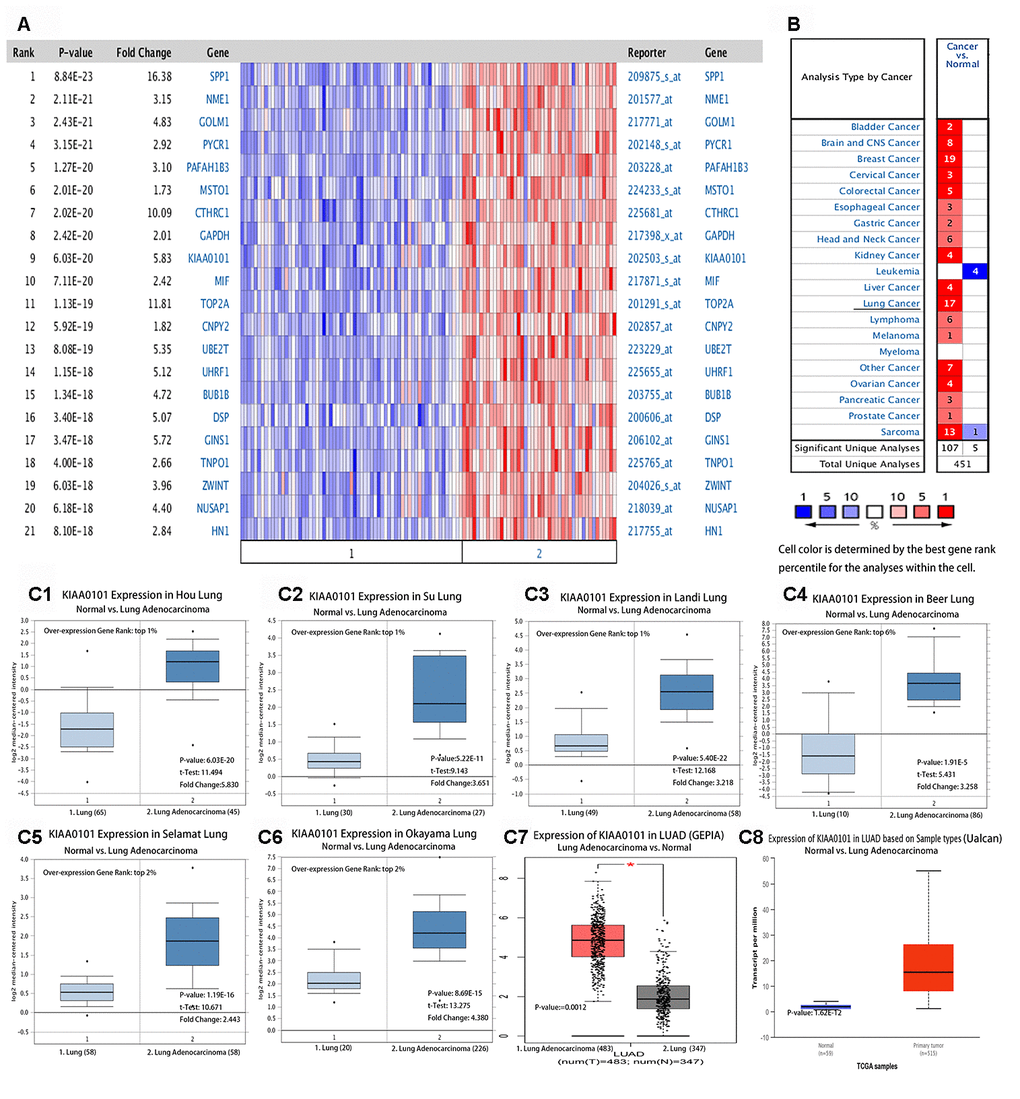 (A) Multigene view of lung adenocarcinoma Heat Maps Comparison of all Genes in the study of Hou lung [50]. The expression of KIAA0101 in lung adenocarcinoma was higher than that in the normal control group. (B) Summary view of KIAA0101. The transcription level of KIAA0101 in different types of cancer. Parameter setting: gene: KIAA0101, threshold (P-value): 0.001, threshold (fold change):2, threshold (gene rank): 10%, data type: DNA and mRNA. Note: The color is standardized by the Z-score to describe the relative value in the row. They cannot be used to compare values between rows. Among them, Red signifies gene overexpression or copy gain in the analyses represented by that cell in the table; blue represents the gene's underexpression or copy loss in those analyses. Datasets comprised samples represented as microarray data measuring either mRNA expression on primary tumors, cell lines, or xenografts. (C) Transcription of KIAA0101 in lung adenocarcinoma (from Oncomine, GEPIA, and Ualcan). mRNA expression levels of KIAA0101 were significantly higher in lung adenocarcinoma than in normal tissue. (C1–C6) Shown are the fold change, associated p-values, and overexpression Gene Rank, based on Oncomine 4.5 analysis. Box plot showing KIAA0101 mRNA levels in, respectively, the Hou Lung, Su Lung, Landi Lung, Beer Lung, Selamat Lung and Okayama Lung datasets [50]. (C7) Expression of KIAA0101 in LUAD based on GEPIA analysis; the p-value was 0.0012. (C8) Shows the expression of KIAA0101 in LUAD based on Ualcan analysis; the p-value was 1.62E-12.