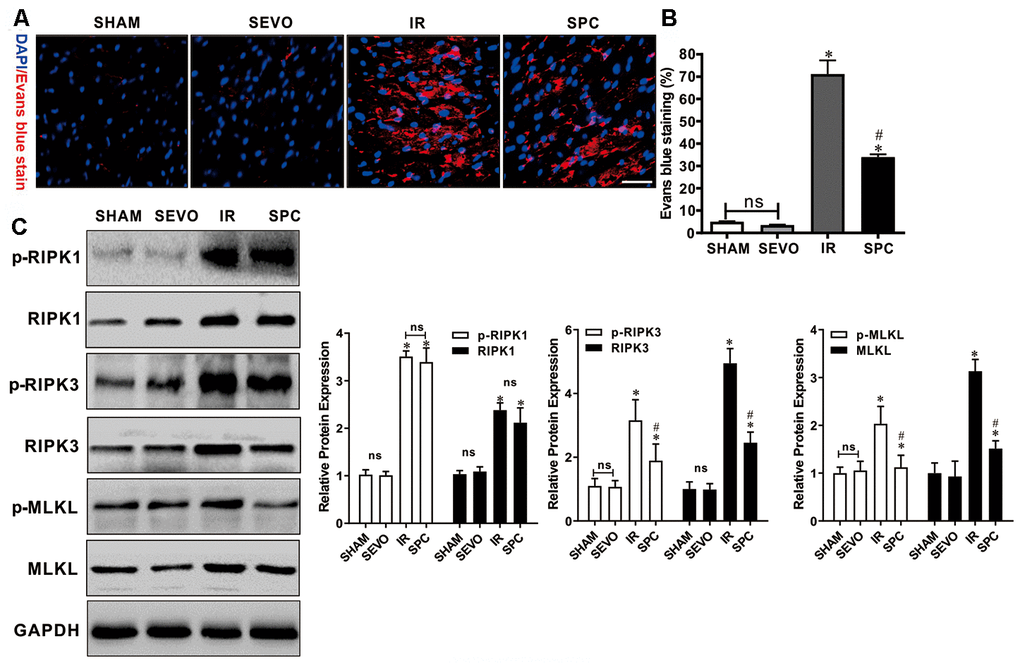 SPC inhibited necroptosis and the up-regulation of RIPK3, MLKL proteins induced by MIRI. (A) Analysis of IR injury induced necroptosis via Evans blue dye uptake in the hearts. (B)The percent area of EBD positive myocardium is shown. n=3/group. (C) Immunoblotting was used to examine the expression levels of p-RIPK1, RIPK1, p-RIPK3, RIPK3, p-MLKL and MLKL proteins. Representative protein images and quantitative analysis were shown. n = 3 /group. The columns and errors bars represent means ± SD. * P P 