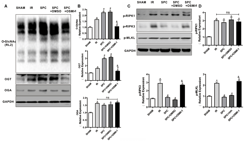 OSMI-1 abolished SPC induced activation in OGT mediated O-GlcNAcylation and reduction in p-RIPK3, p-MLKL. (A, B) Expressions of O-GlcNAc, OGT and OGA in all groups were analyzed by Western Blot. Representative protein images and quantitative analysis were shown. n=3/group. (C, D) Representative protein images and quantitative analysis of p-RIPK1, p-RIPK3, and p-MLKL in all groups were presented. n=3/group. OSMI-1, the OGT inhibitor; DMSO, the OSMI-1 solvent. The columns and errors bars represent means ± SD. * P 