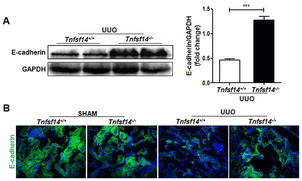 Increased renal tubular cell integrity in Tnfsf14-deficient mice after UUO. Kidney tissues of Tnfsf14+/+ and Tnfsf14−/− mice were collected after UUO surgery for 7 days. (A) E-cadherin expression in kidney tissues was measured by western blot. Representative western blot (Left) and quantitative data (Right) are presented. (B) E-cadherin expression in kidney tissues was measured by immunofluorescence. Sham group was used as the control of UUO. The data were representative of the results of three independent experiments. Values are represented as mean ± SEM. Original magnification ×400. n = 5 per group. ***P 