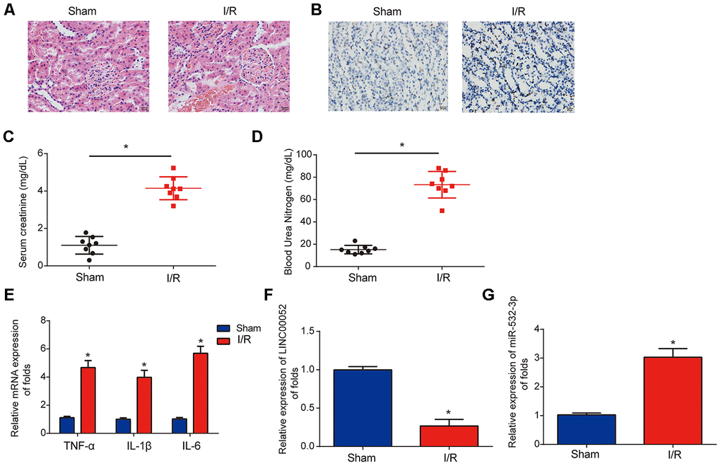 Analysis of LINC00052 and miR-532-3p expression in AKI rat models triggered by I/R surgery. (A) Renal histology micrographs of renal tissues from I/R-induced AKI rat models. Scale bars = 20 μm. (B) TUNEL assays measuring apoptosis in renal tissues from I/R-induced AKI rat models. Serum levels of SCr (C) and BUN (D) in renal tissues from I/R-induced AKI rats 24 h after surgery. (E) The expression of IL-1β, IL-6 and TNF-α mRNAs in renal tissues from I/R-induced AKI rats 24 h after surgery was assessed by qRT-PCR. Analysis of LINC00052 (F) and miR-532-3p (G) expression in renal tissues from I/R-induced AKI rats using qRT-PCR. Three independent experiments were performed (n = 8 in each group). Error bars represent the mean ± SD of triplicate experiments (at least). *p 