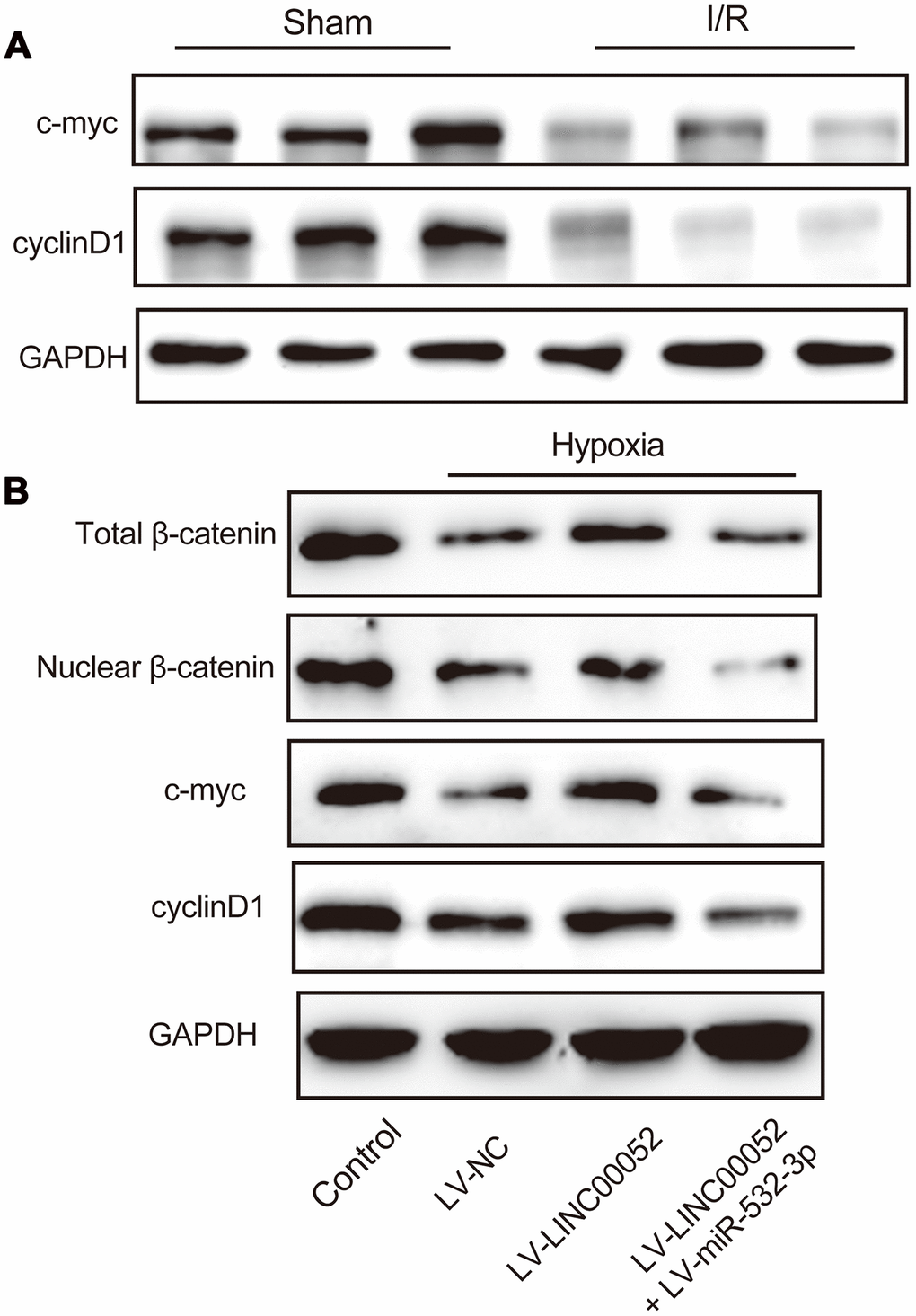 miR-532-3p abolishes the repressive effect of LINC00520 by inactivation of the Wnt/β-catenin pathway in NRK-52E cells. (A) IHC staining of c-myc and cyclin D1 in AKI rat models. (B) Expression of β-catenin, c-myc, and cyclin D1 proteins in NRK-52E cells infected with a combination of LV-LINC00052 and LV-miR-532-3p or LV-LINC00052 and LV-miR-532-3p. Three independent experiments were performed. Error bars represent the mean ± SD of triplicate experiments (at least). *p 