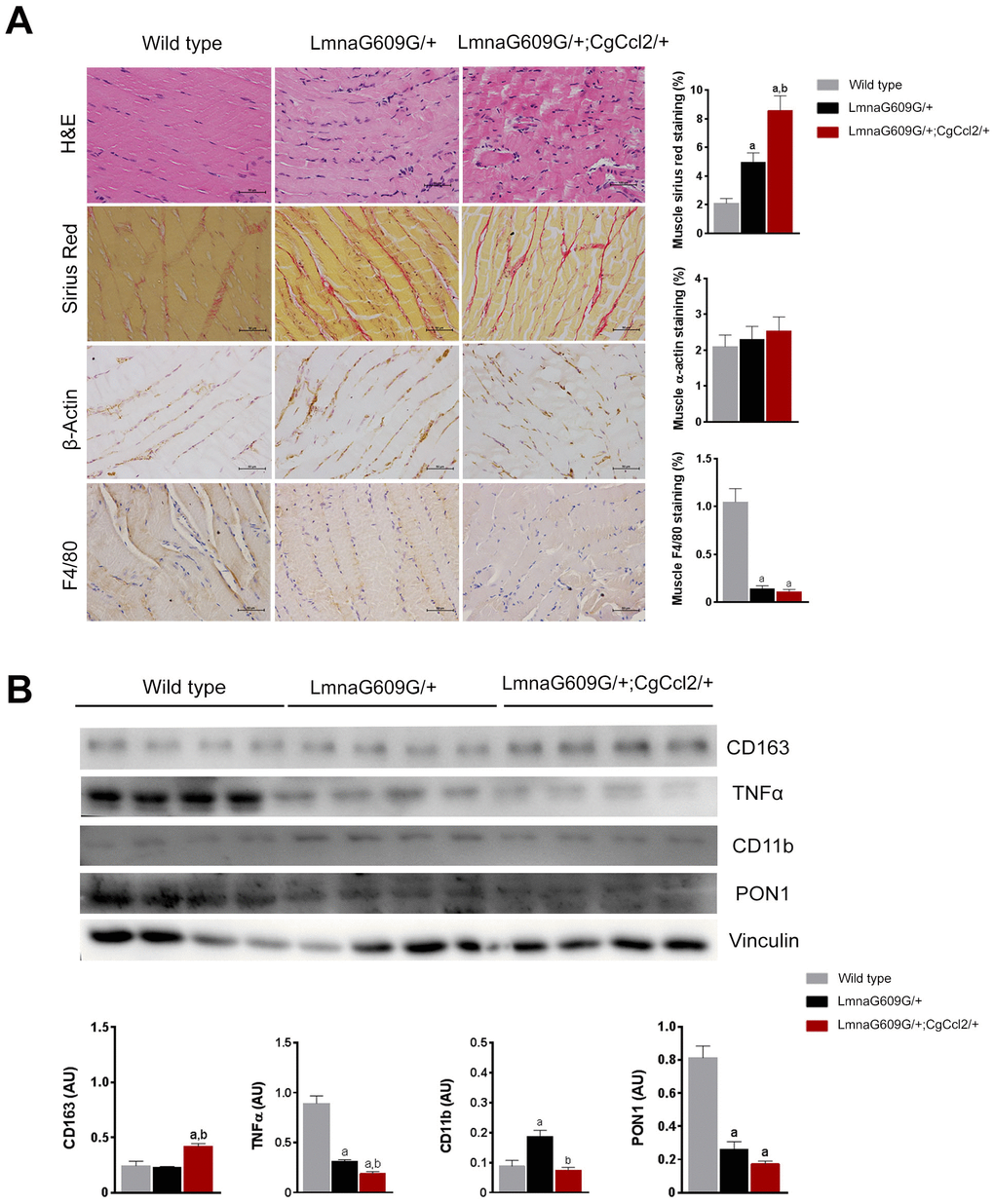 Histological phenotypes were altered in the muscles of aged mice. The structural changes in quadriceps muscles are depicted in representative micrographs of tissue stained with hematoxylin and eosin and Sirius red staining and determined by immunohistochemical analysis of β-actin and F4/80 cells. Ccl2 overexpression accelerated the presence of histological alterations (A). Fibrosis was a prominent feature in the progeroid mice, but the relative amount of actin-stained cells was similar among strains, despite major differences in muscle weight. Interestingly, the number of F4/80-stained cells was significantly lower in the progeroid mice. We then used immunoblotting to examine (B) the expression of the markers of macrophage polarization, including cluster of differentiation (CD) 11 and 163, and tumor necrosis factor (TNFα) to indicate the relative anti-inflammatory activity, which was accompanied by lower expression of the major antioxidant enzyme paraoxonase 1 (PON1) in both progeroid strains. The LMNAG609G/+;CGCCL2+/- mice were compared with wild-type mice, as depicted by a p+/- mice, as depicted by b p