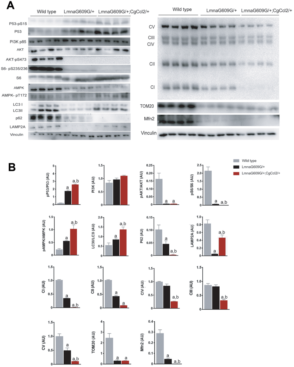 Ccl2 overexpression significantly altered the expression of the complexes related to oxidative phosphorylation and the relevant metabolic signaling pathways in the quadriceps muscle. Ccl2 overexpression exacerbated the metabolic reduction, mainly in mitochondria, (A) of the mice with accelerated aging and altered (B) the functioning of AMPK-mTOR-driven pathways. LMNAG609G/+;CGCCL2+/- and LMNAG609G/+ denote progeroid mice overexpressing and not overexpressing Ccl2, respectively. Values are shown as the means ± SEM; a pb p