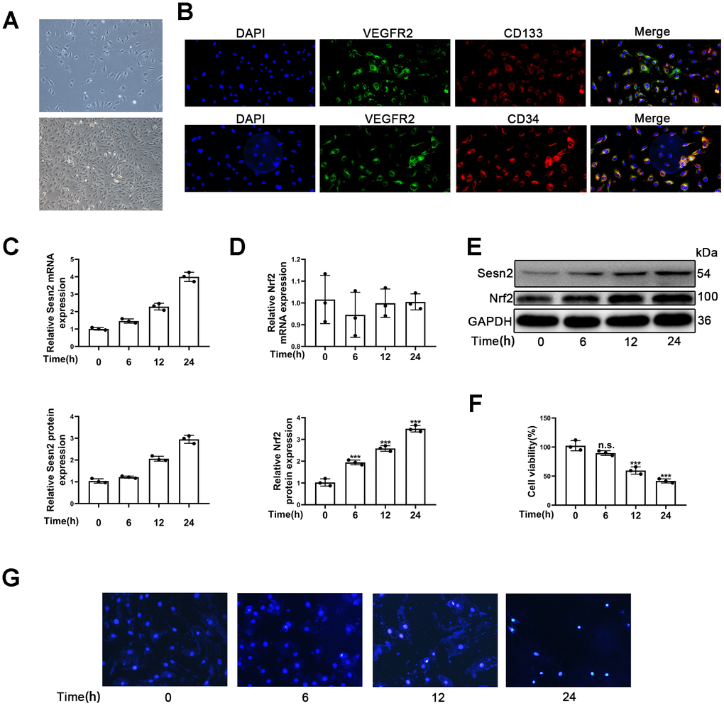 Identification of EPCs and Ang-II increased Sesn2 and Nrf2 protein expression in EPCs. Identification and exposures of EPCs to Ang-II for prolonged periods of time. (A) EPCs (passage (P) 1) from human umbilical cord. Scale bars = 5 μm and Scale bars = 40 μm. (B) We used immunofluorescence to detect the measures of CD31, CD34, CD134, and VEGFR2. (C) The treatments with Ang-II caused an increased levels of Sesn2 mRNA in EPCs. (D) The levels of Nrf2 mRNA were unchanged in EPCs exposed to Ang-II. (E) The treatments with Ang-II increased the levels of Sesn2 and Nrf2 proteins in EPCs. (F) We used Hoechst 33258 to detect the apoptosis of EPCs and found that the treatments with Ang-II caused an increase in the apoptosis of EPCs. Scale bars = 5 μm. All experiments were performed in triplicate. *p G) We used Hoechst 33258 staining to detect the apoptosis of EPCs. Scale bars = 5 μm.