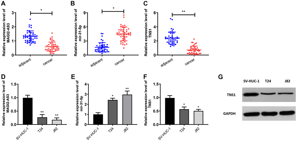 Expression levels of MAGI2-AS3, miR-31-5p and TNS1 in BCa tissues and cell lines. (A–C) QRT-PCR analysis results show the expression levels of MAGI2-AS3, miR-31-5p and TNS1 in BCa and adjacent normal tissues (n=45). (D–F) QRT-PCR analysis results show the expression levels of MAGI2-AS3, mir-31-5p and TNS1 in the normal urothelial cell line (SV-HUC-1) and BCa cell lines (T24 and J82). (G) Western blot analysis shows the expression of TNS1 in the normal urothelial cell line (SV-HUC-1) and BCa cell lines (T24 and J82). GAPDH was used as an internal control. *p