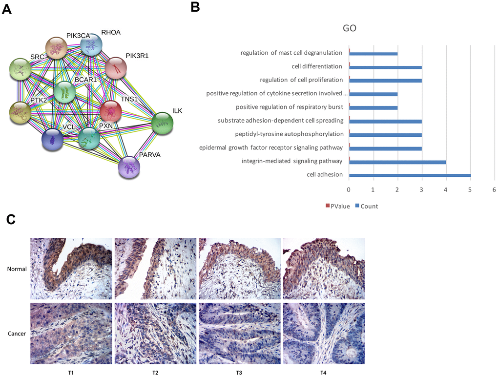 Top GO terms associated with TNS1 and immunohistochemical analysis of TNS1 expression in BCa and normal urothelial tissues. (A) STRING database analysis shows the protein interaction network between TNS1 and TNS1-related proteins. The nodes represent proteins and the lines represent protein-protein interactions. (B) Top 10 GO terms related to TNS1 and TNS1-related proteins based on functional enrichment analysis using DAVID. The blue bars represent the number of TNS1-related genes in each GO term. (C) Immunohistochemical analysis results show TNS1 protein expression in BCa and adjacent normal urothelial tissues from T1, T2, T3 and T4 stage BCa patients.