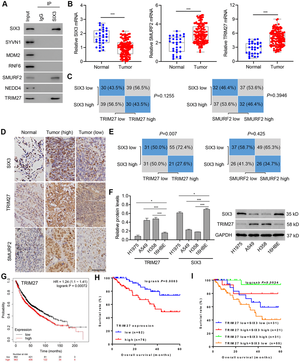 TRIM27 and SIX3 expression levels and correlation analysis in lung cancer cells and tissues. (A) A549 cell lysates underwent co-immunoprecipitation with anti-SIX3 or control IgG antibody. The immunoprecipitates were then immunoblotted with the indicated antibodies. TRIM27, SMURF2, and SIX3 expression in lung cancer tissues (n = 138) and adjacent normal lung tissues (n = 30) in our independent hospital cohort was detected by quantitative real-time PCR (B) and immunohistochemistry (D). (C, E) Correlation analysis of SIX3, SMURF2, and TRIM27 in lung cancer tissues (n = 138). Statistical analyses were performed using the Chi-square test. (F) TRIM27 and SIX3 expression in cells from the NSCLC cell lines H1975, A549, and H358, and the human bronchial epithelial cell line 16HBE were measured by western blot analysis. Survival probability of patients with lung cancer from a Kaplan-Meier Plotter database (G) and our independent hospital cohort (H, I). Scale bar: 50 μm. All experiments were repeated at least three times, and data are represented as mean ± SD. (B) ***P F) *P P 