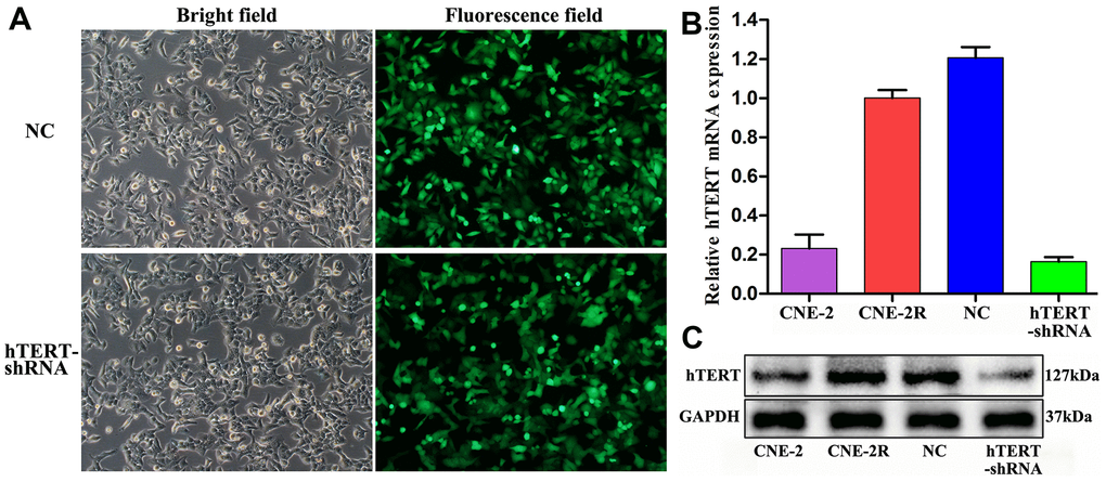 Effective silencing of hTERT. (A) CNE-2R cell infection rate observed under an inverted fluorescence microscope (200×); (B) hTERT mRNA expression detected by qPCR; (C) hTERT protein expression detected by Western blot assay.