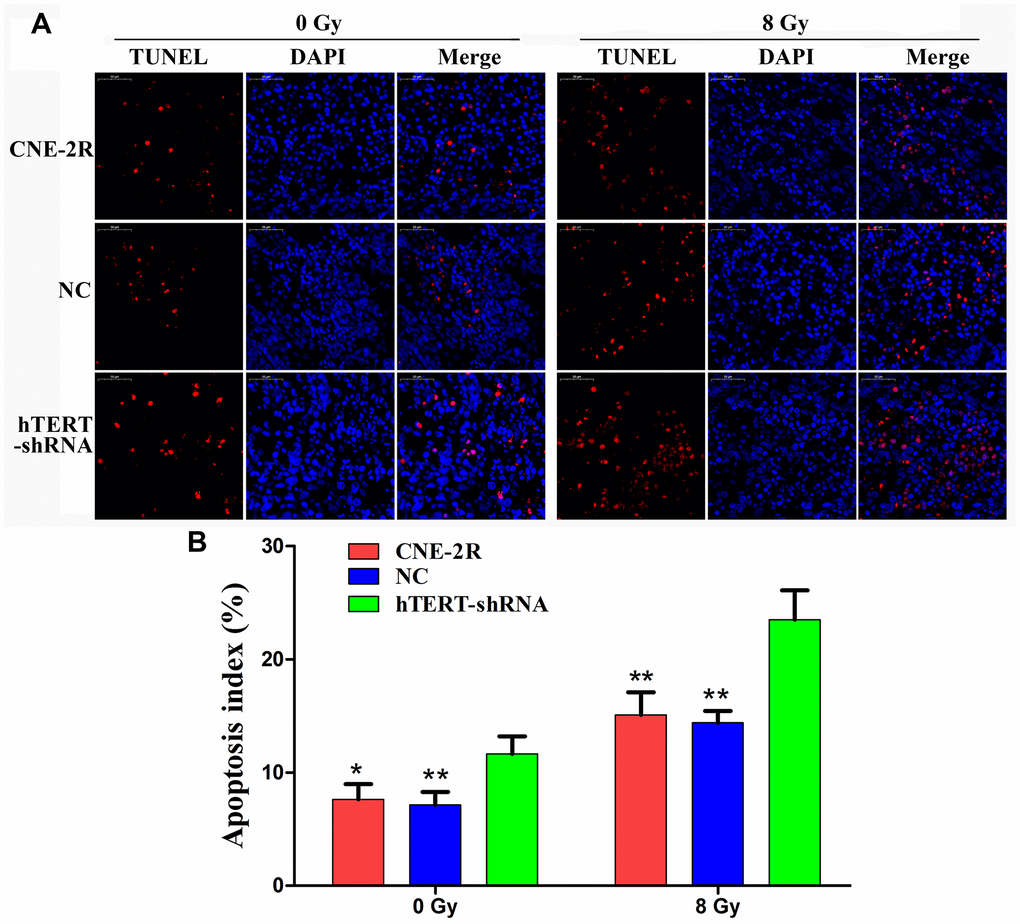 hTERT silencing could induce apoptosis in vivo. (A) Apoptotic cells in tumors detected by TUNEL, red fluorescence (TMR red) represents positive apoptotic cell nucleus, while blue fluorescence (DAPI) was used for nuclear localization (200×); (B) Histogram of the apoptosis index in each group (* indicates P