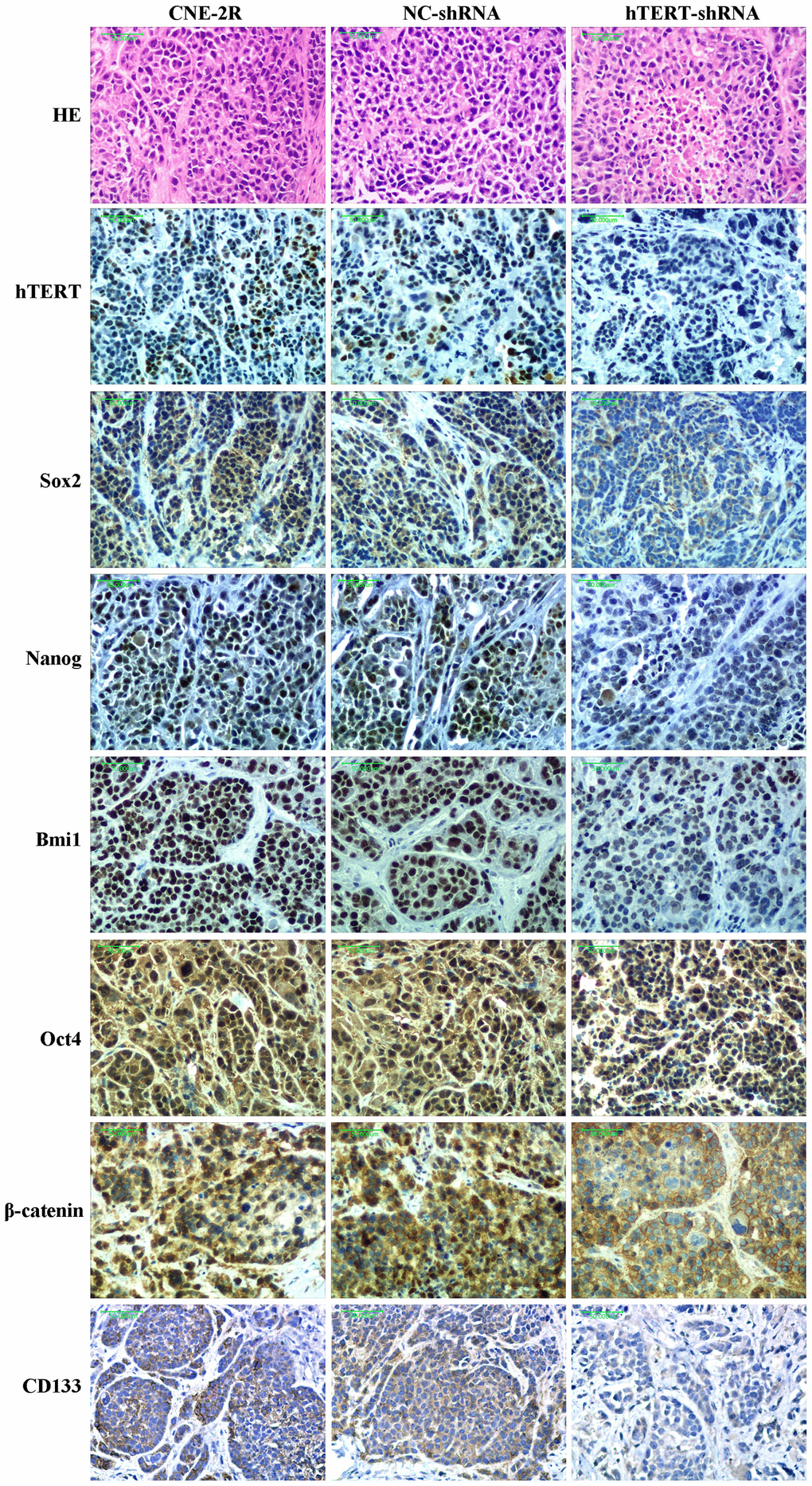 Histological morphology and expression of hTERT, Sox2, Nanog, Bmi1, Oct4, CD133 and β-catenin proteins in each group (200×).