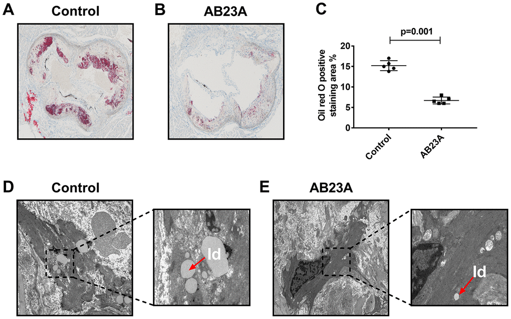 AB23A improves atherosclerotic lesions in ovariectomized ApoE-/- mice. Ovaries were removed from 8-week-old female ApoE-/- mice, and the mice were fed a high-fat diet with saline or AB23A (2.55 mg/kg) daily for 12 weeks. (A, B) Representative image of oil red O staining of the aortic arch. Original magnification: 40×. (C) Quantification of lipid area in plaques (n=5/group) The P-value represents the comparison with the control group. The data are expressed as the mean ± SEM (n=5/group). (D, E) TEM image of the aortic arch of ovariectomized ApoE-/-mice. Red arrow, lipid droplets. The original magnifications of the images in the same group are 1.2k× (left) and 5.0k× (right).