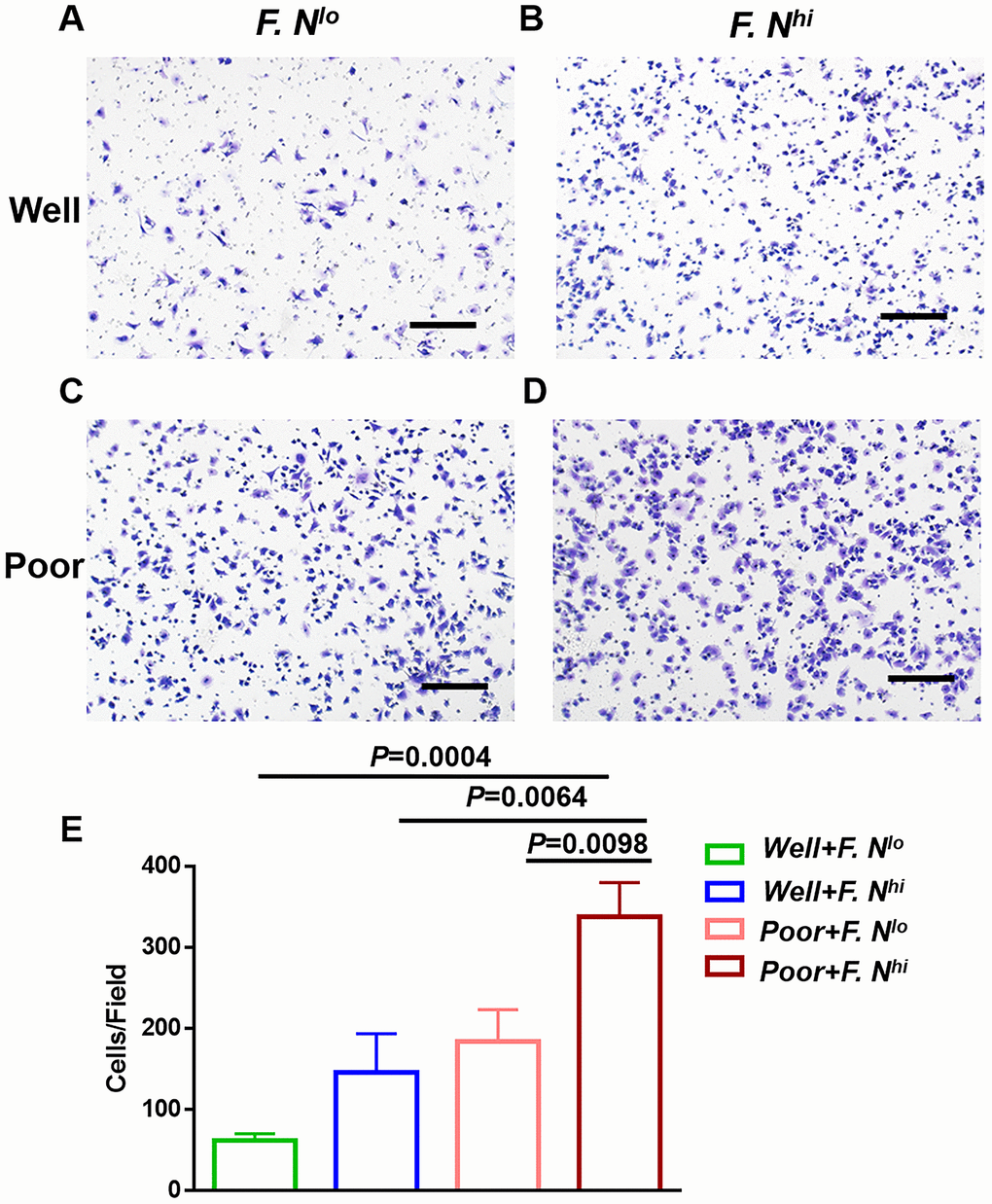 High levels of intratumoral F. nucleatum are associated with cancer cells invasion capacity. Representative Matrigel transwell for cells sorted for well differentiation and low (A) or high (B) amounts of F. nucleatum, or poor differentiation and low (C) or high (D) levels of intra-tumor F. nucleatum. (E) Statistical analyses of invasion cells for these groups. Scale bar = 500μm. Data are expressed as mean±SD (bars). All experiments were performed in triplicate.
