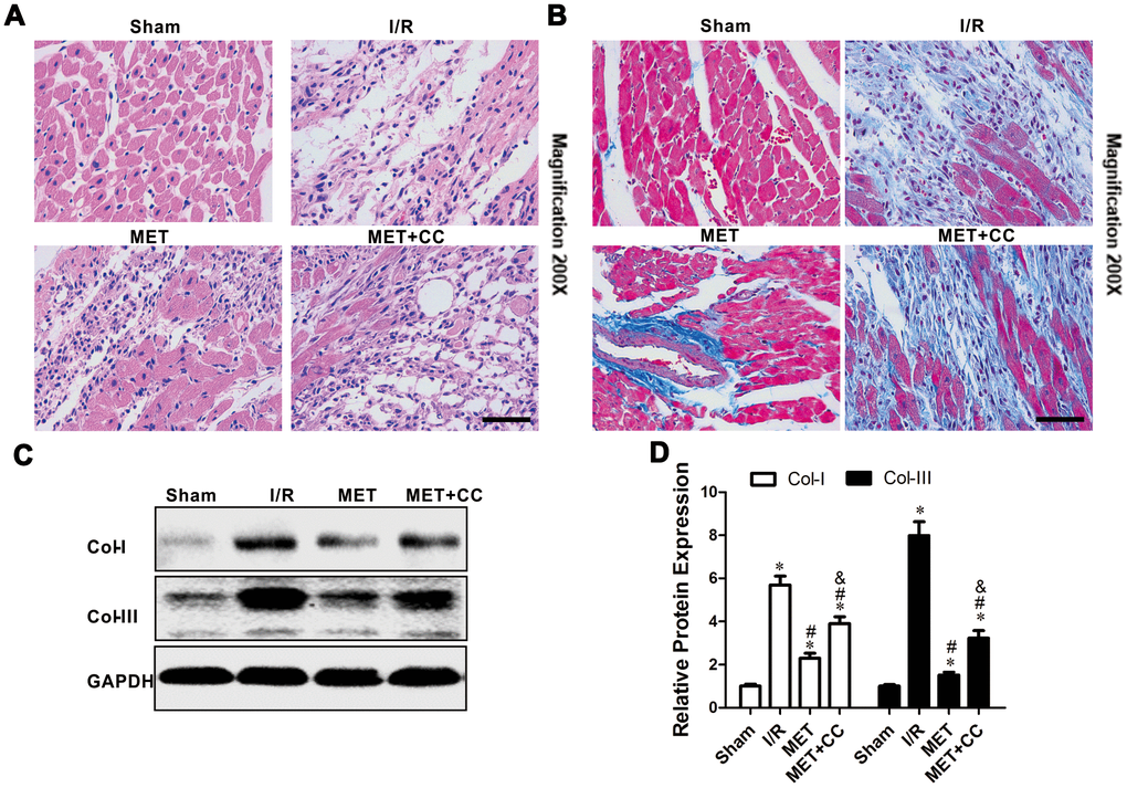 Metformin protected I/R injury-induced myocardial injury by suppressing collagen synthesis. (A) Representative pictures of H&E-stained cardiac sections and (B) representative images of myocardial fibrosis stained with the Masson trichrome method (n = 4 per group). Magnification 200x, Scale bar = 100μm; (C) Collagen-related proteins in the ischemic area, including COL-I, COL-III and GAPDH were examined by Western blot analysis. (D) Quantitative analysis of COL-I and COL-III expression (n = 4 per group). Values are expressed as the mean ± SEM. * P P P 