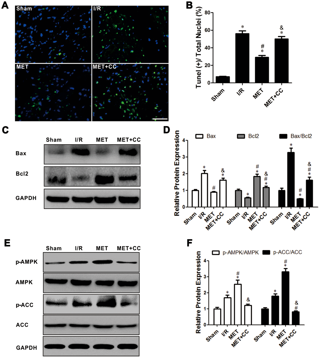 Activation of AMPK with Metformin protected against myocardial I/R injury induced apoptosis. (A) Top representative TUNEL-stained (green fluorescence) and DAPI-stained (blue fluorescence) photomicrographs are shown (Magnification 200x, Scale bar = 50 μm). (B) Bar graph represents the quantification of apoptotic cells (green fluorescence)/the total number of nucleated cells (blue fluorescence, n = 6 per group). (C) Apoptosis-related proteins in the ischemic area, including Bax, Bcl2 and GAPDH were examined by Western blot analysis. (D) Quantitative analysis of Bax, Bcl2 and calculate the ratio of Bax/Bcl2 (n = 4 per group). (E) AMPK pathway-related proteins in the ischemic area, including p-AMPK, AMPK, p-ACC, ACC and GAPDH were examined by Western blot analysis. (F) Quantitative analysis of p-AMPK, AMPK, p-ACC, ACC expression and calculate the ratio of p-AMPK/AMPK and p-ACC/ACC (n = 4 per group). Values are expressed as the mean ± SEM. * P P P 