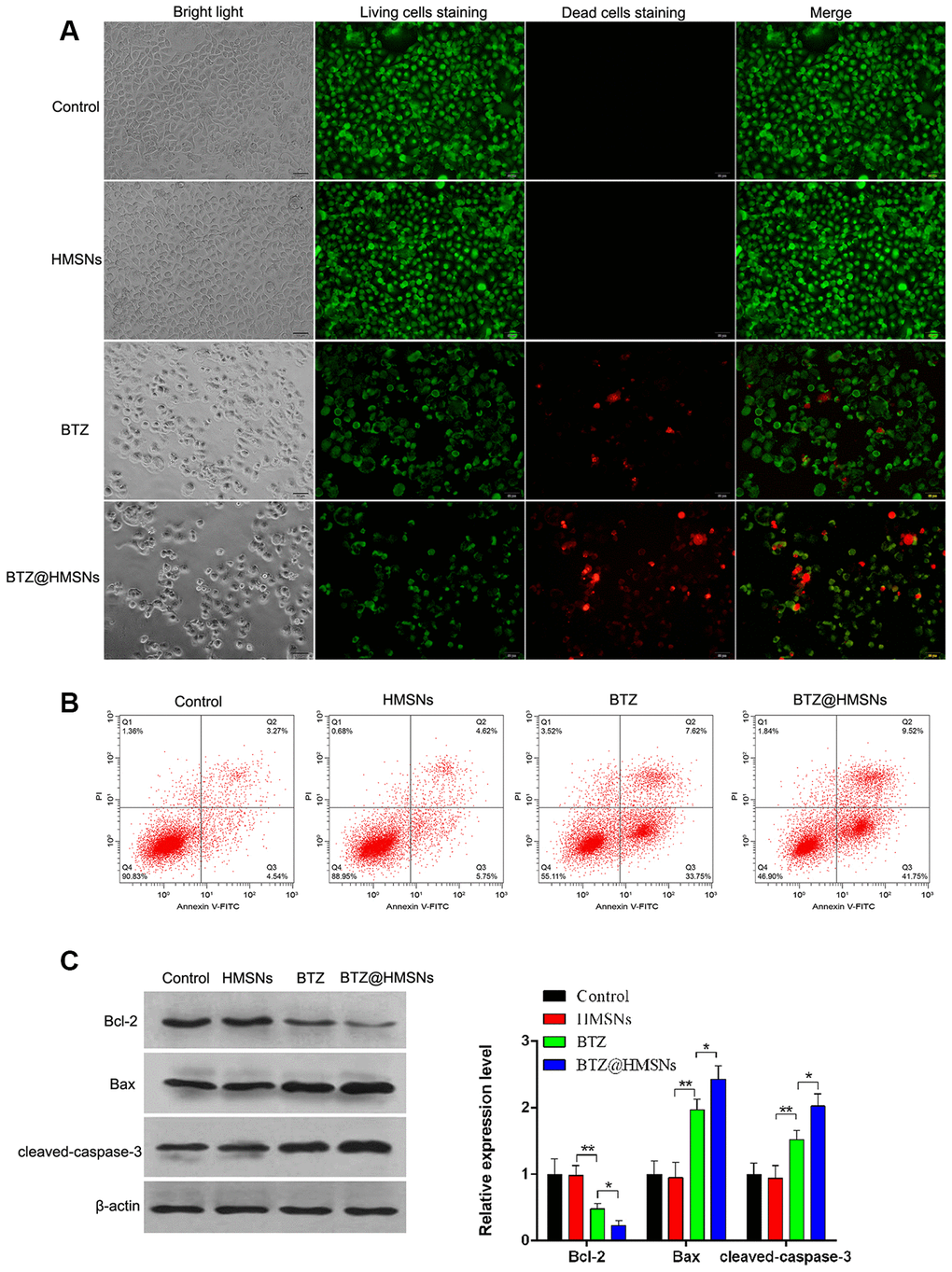 BTZ@HMSNs augments cell death of lymphoma. (A) Live/dead staining detection for SNK-1 cells treated with PBS (control), HMSNs, BTZ (75 nM), BTZ@HMSNs (containing 75 nM of BTZ). Scale bar equals 5 nm. (B) Cell apoptosis rate of SNK-1 cells treated with PBS (control), HMSNs, BTZ, BTZ@HMSNs by flow cytometry analysis. (C) The expression of apoptosis-related proteins (Bcl-2, Bax, and cleaved-caspase-3) in SNK-1 cells treated with PBS (control), HMSNs, BTZ, BTZ@HMSNs by western blotting. BTZ, bortezomib; HMSNs, hollow mesoporous silica nanospheres. The differences between groups were analyzed by one-way ANOVA followed by multiple comparison with Tukey test. *P P 