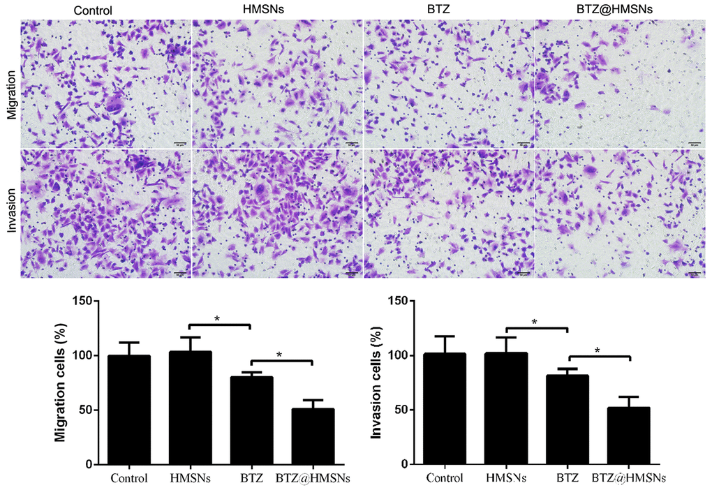 Cell migration and invasion of SNK-1 cells treated with PBS (control), HMSNs, BTZ (75 nM), BTZ@HMSNs (containing 75 nM of BTZ) by Transwell assay. Scale bar equals 5 nm. BTZ, bortezomib; HMSNs, hollow mesoporous silica nanospheres. The differences between groups were analyzed by one-way ANOVA followed by multiple comparison with Tukey test. *P 