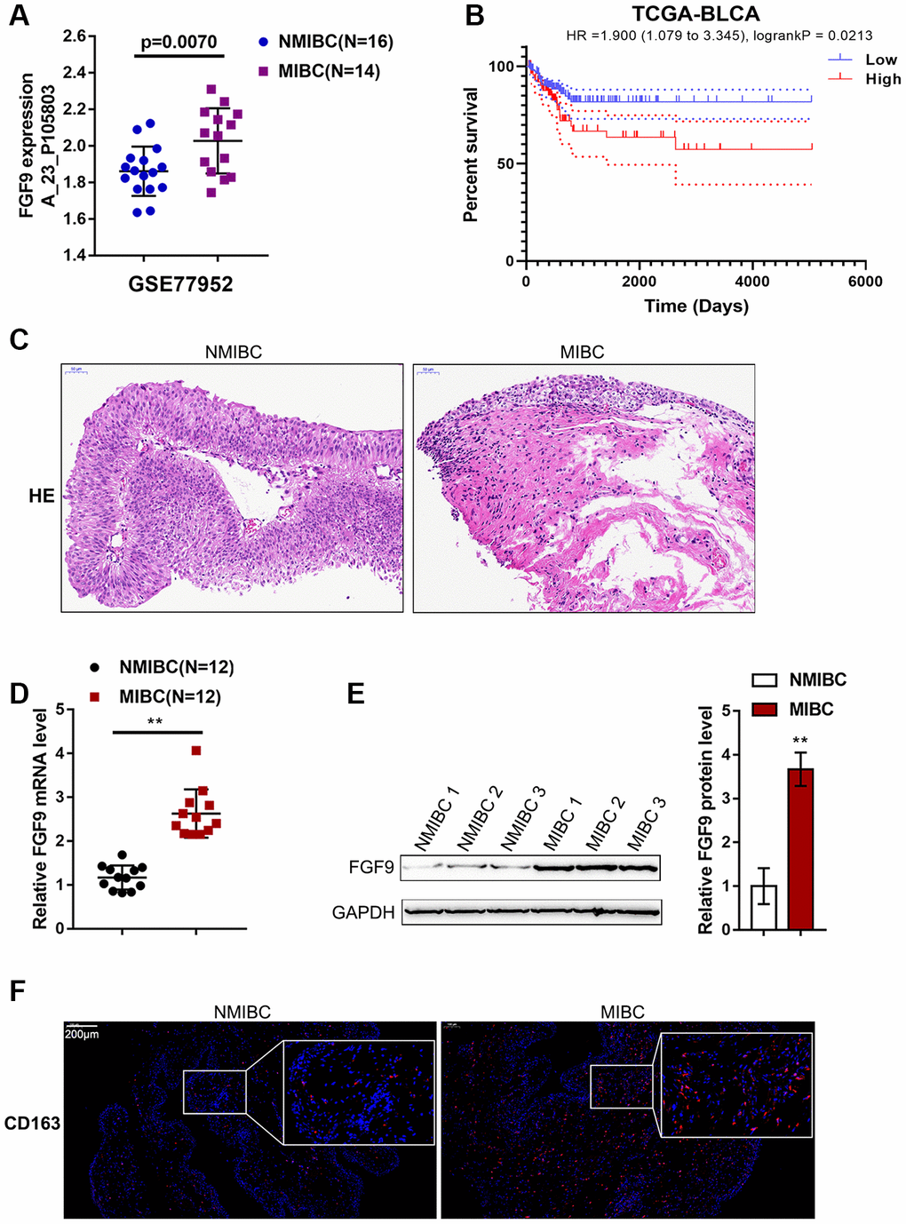 Expression of FGF9 in muscular invasive bladder cancer (MIBC) and non-muscular invasive bladder cancer (NMIBC) tissues. (A) The expression of FGF9 in MIBC and NMIBC tissues based on the data from GSE77952. P=0.007, student’s T test. (B) The overall survival of patients with bladder cancer was analyzed by grouping the samples based on FGF9 expression using log-rank test. Data are based on TCGA database. (C) The pathological changes in MIBC and NMIBC tissues was shown by H&E staining. (D) The expression of FGF9 in tissues of 12 cases of MIBC and 12 cases of NMIBC was determined using real-time PCR. PE) The protein levels of FGF9 in tissues of 12 cases of MIBC and 12 cases of NMIBC were determined using immunoblotting. PF) The protein distribution of CD163 (M2 macrophage marker) was determined in MIBC and NMIBC tissues using immunofluorescence (IF) staining.