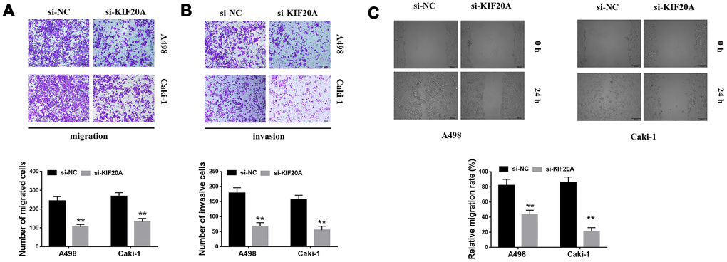 KIF20A regulates the invasion of renal cancer cells. (A, B) Downregulation of endogenous KIF20A reduced the number of invasion and migration cells in the transwell assay; (C) Wound-healing assay revealed that downregulation of endogenous KIF20A significantly reduced the migration rate.